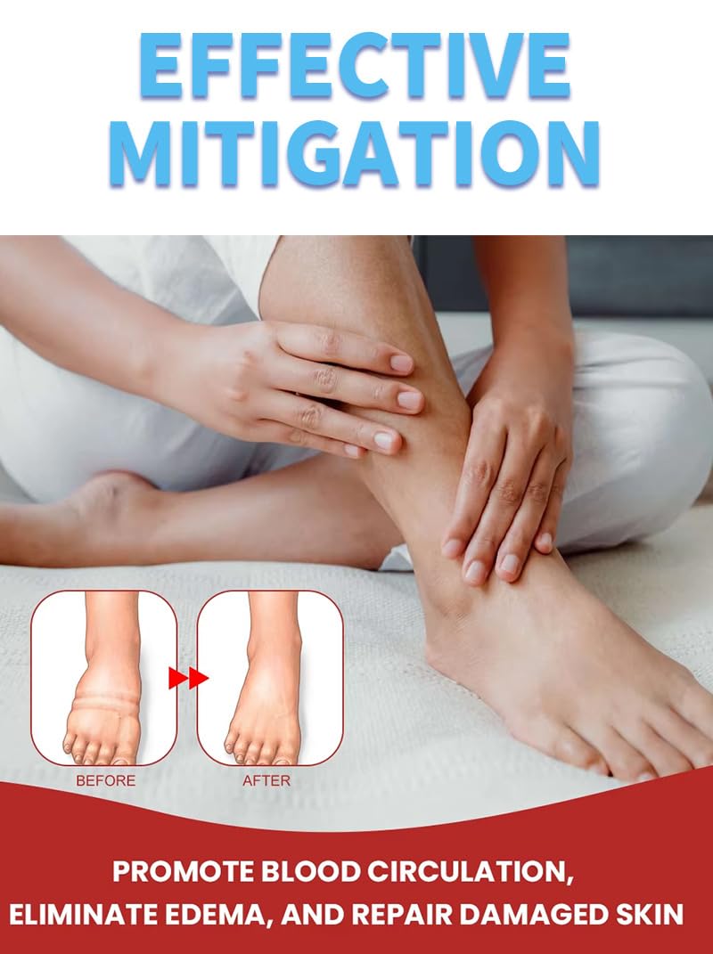 Leg Slimming Massage Cream | Soothing Swelling, Tightening Skin, Auxiliary Care for Reducing Edema （2 Pieces） bobojuju uk supplements