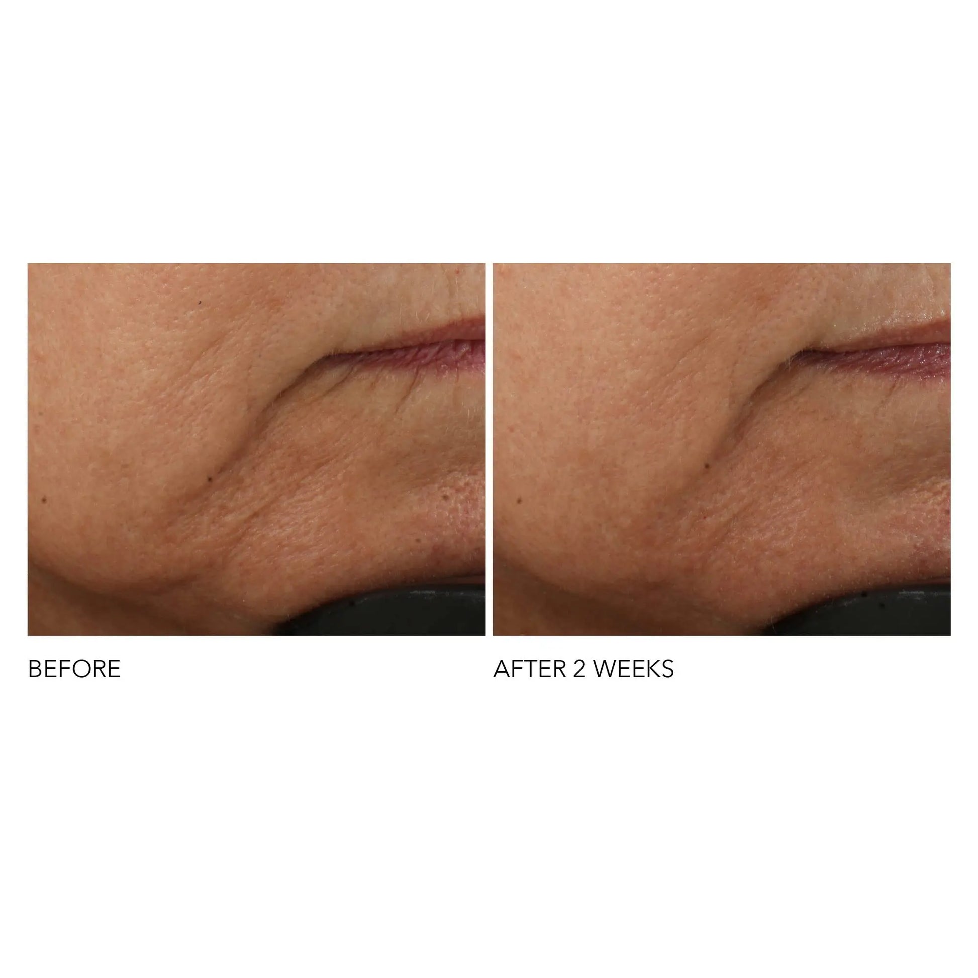Dr Dennis Gross Advanced Retinol + Ferulic Intense Wrinkle Cream | Intensely Hydrating to Visibly Transform Skin and Repair the Moisture Barrier | 2 oz Dr Dennis Gross uk supplements