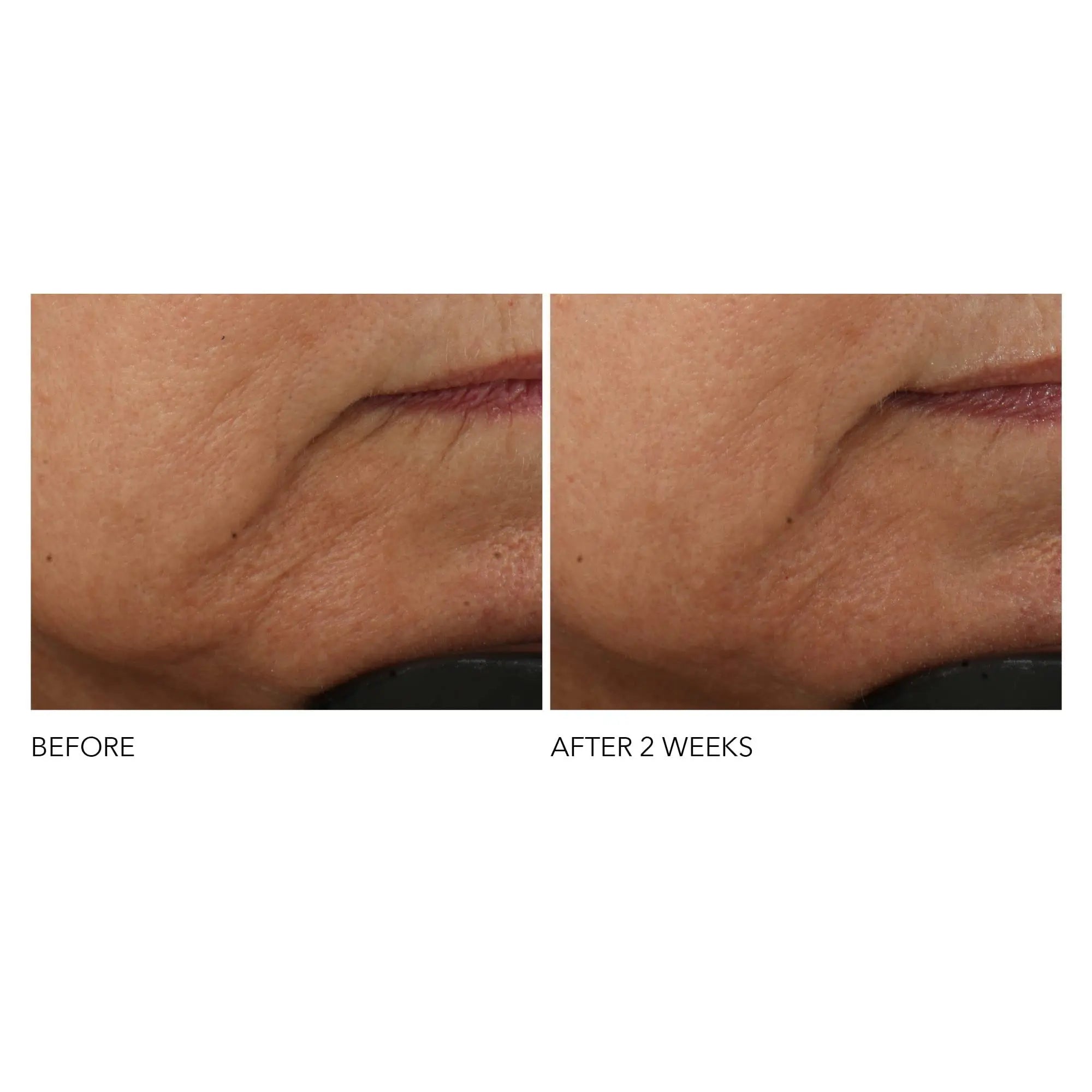 Dr Dennis Gross Advanced Retinol + Ferulic Intense Wrinkle Cream | Intensely Hydrating to Visibly Transform Skin and Repair the Moisture Barrier | 2 oz Dr Dennis Gross uk supplements