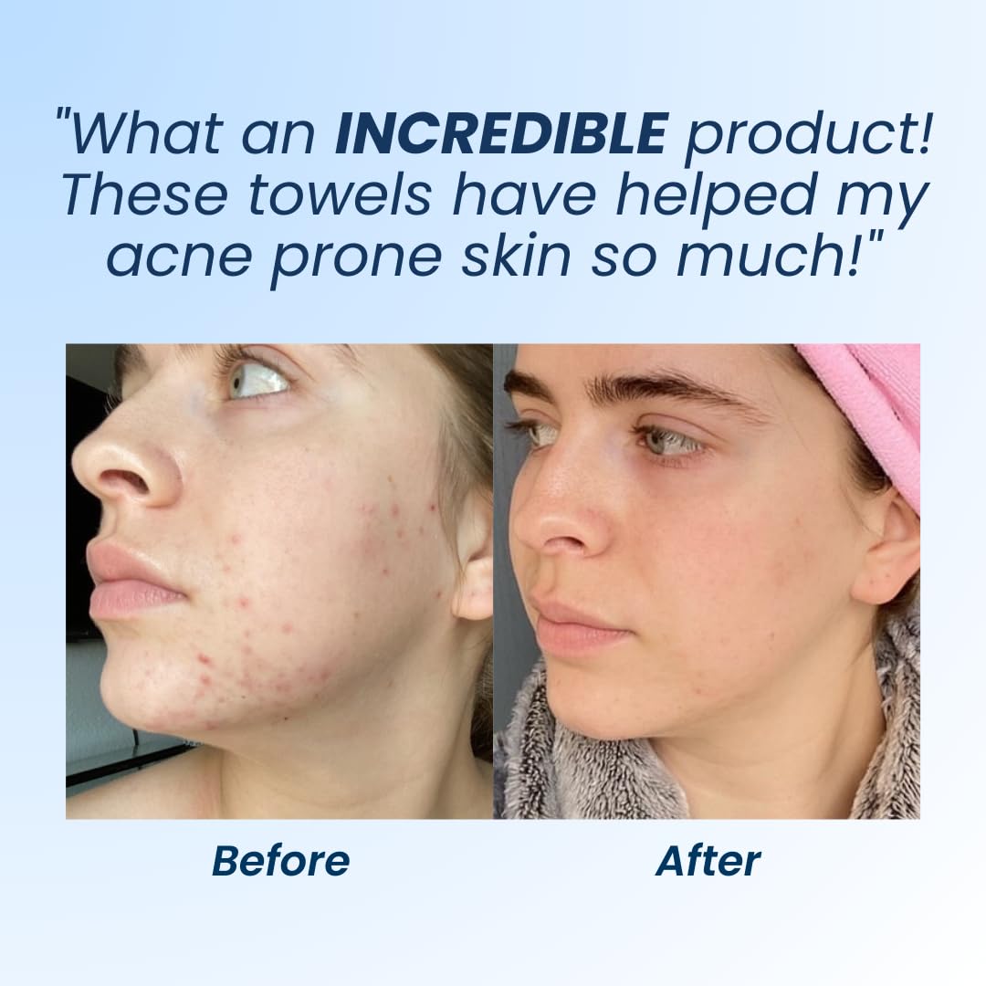 Clean Skin Club Clean Towel XL, 100% USDA Biobased Dermatologist CLEAN SKIN CLUB uk supplements