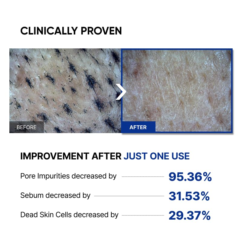 SAYNID MICROBIOME RENEWING CREAM MASK TRIAL KIT, Wash-off Cream, Soft Exfoliating Face Scrub Dead Skin Cells | 4.5g/0.15oz (3EA) SAYNID uk supplements