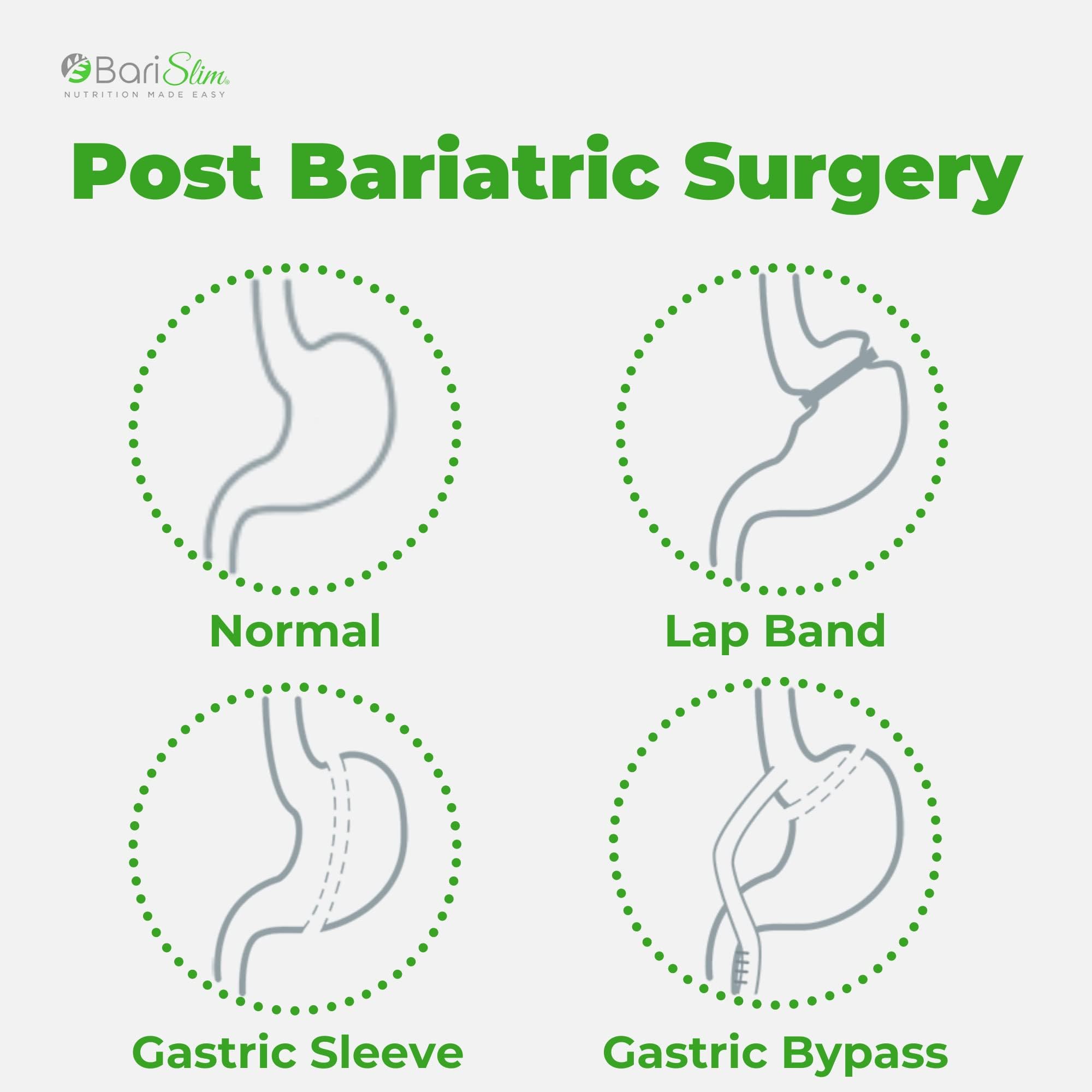 BariSlim Bariatric Calcium Citrate Plus Powder - Formulated for Patients After Weight Loss BariSlim uk supplements