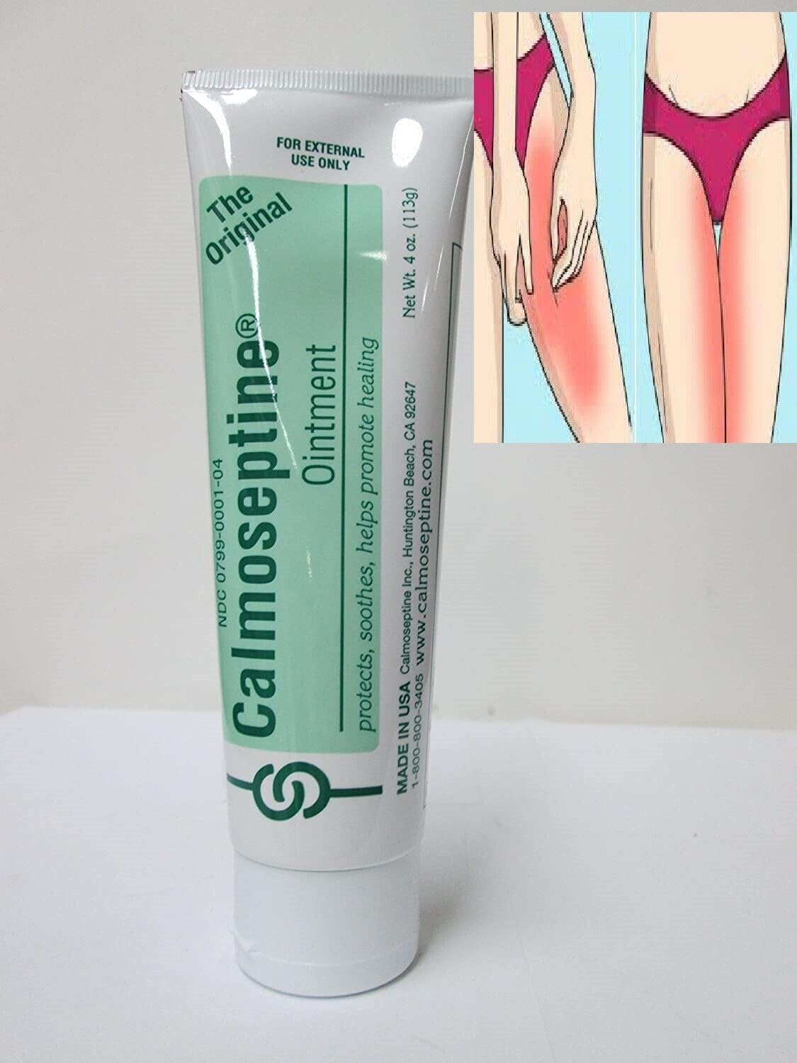 Crema para Infecciones Vaginales Elimina hongos Picazon Irritación Pomada Vagina Generic uk supplements
