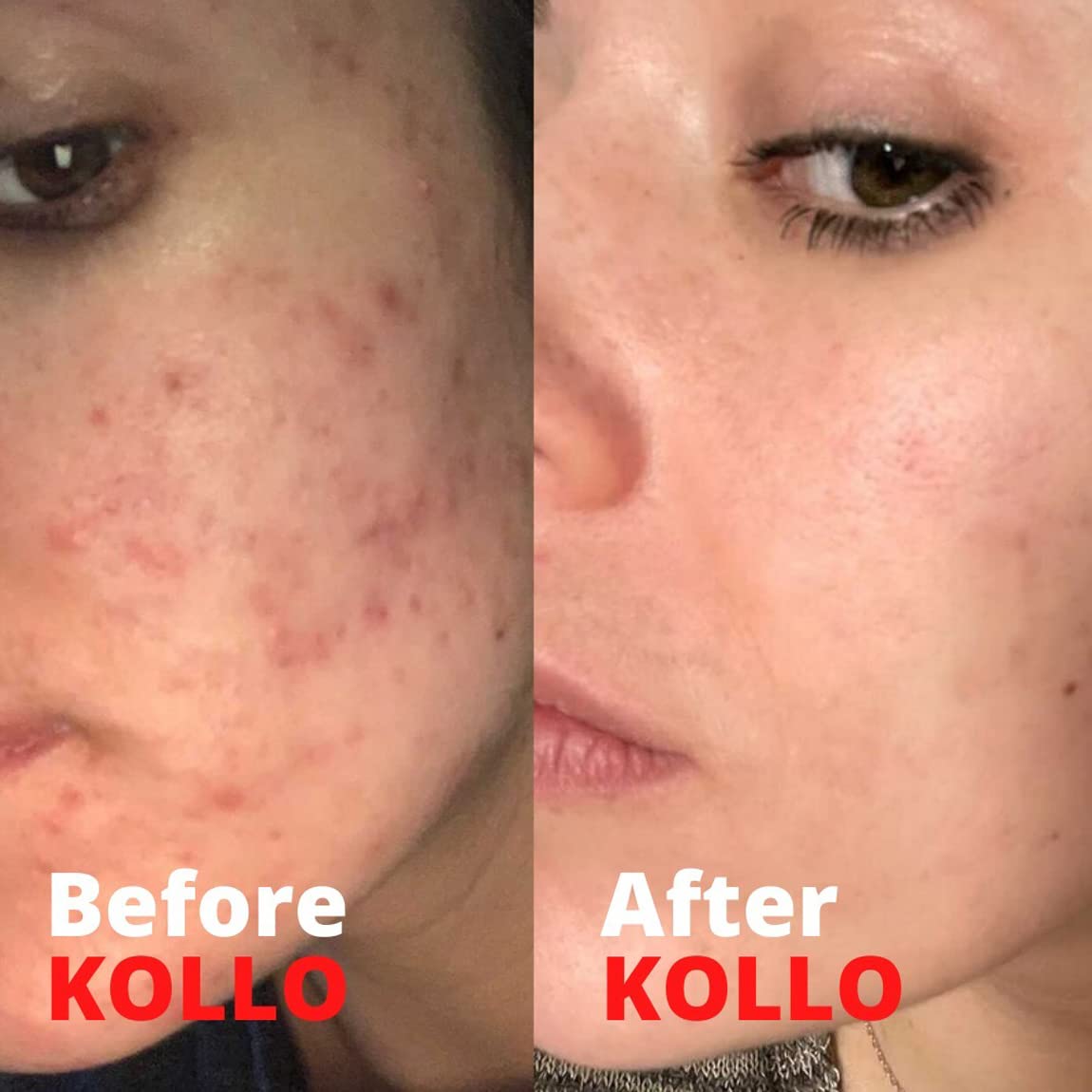 Kollo Premium Marine Collagen Liquid, 10,000 mg - Essential Proteins Collagen Peptides Kollo uk supplements