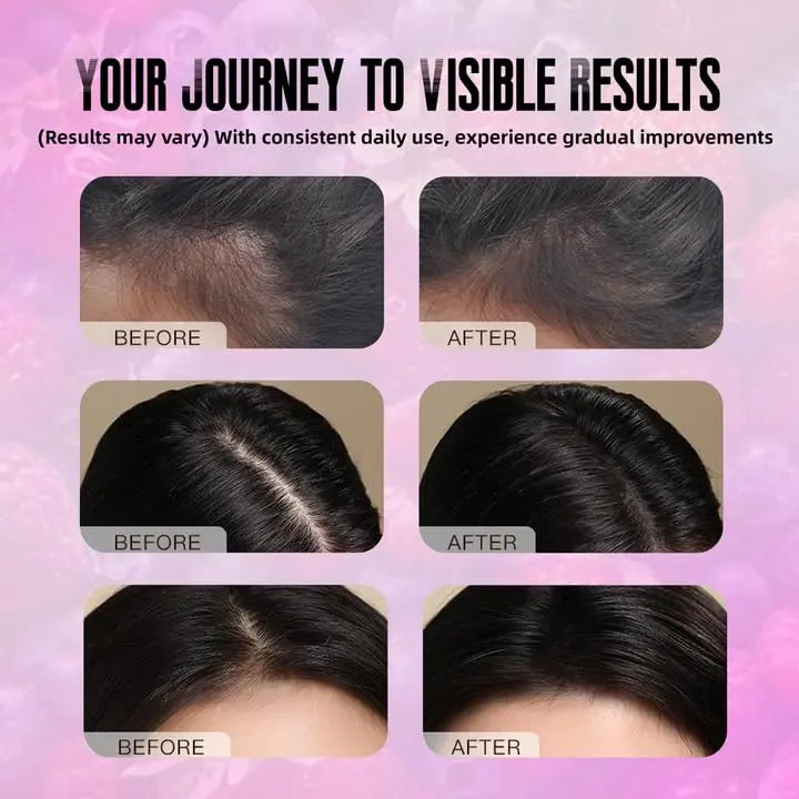 BDQBDQ Lumin Hair Growth Gummies, Infused with Biotin, Vitamins, and Botanical Extracts to Support Healthy Hair Growth and Strength BDQBDQ uk supplements