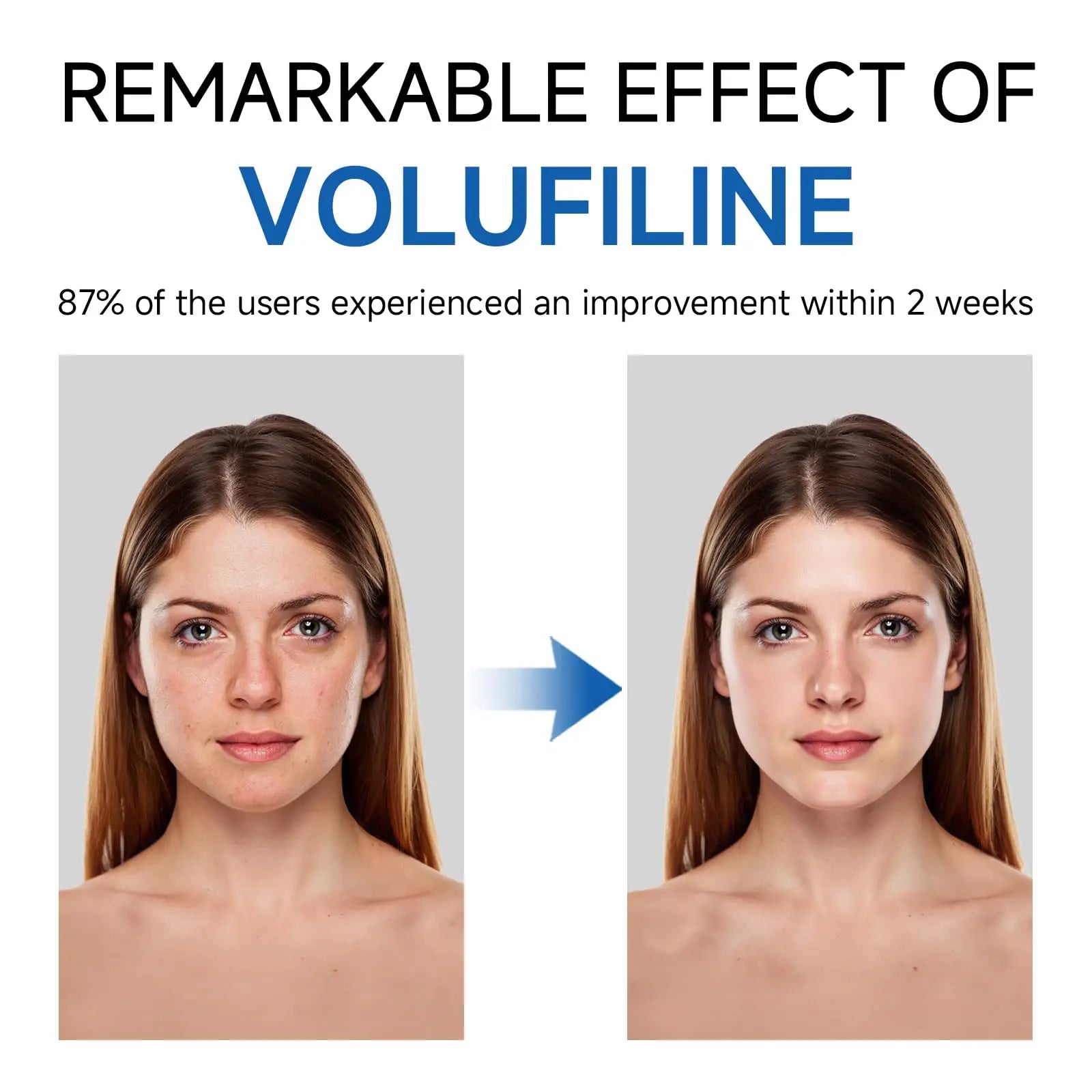 Volufiline Serum, Volufiline Under Eye Serum, Cosmetic Grade Ampoule for Skin Elasticity Improvement, Face & Body Fine Lines, Hydrating Texture, 10ml*2 GUDE GUDE uk supplements