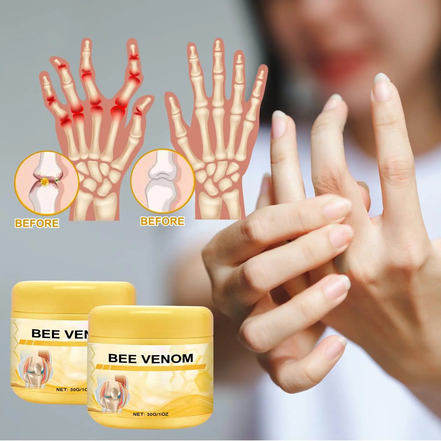 Botou 2PCS New Bee Venom Professional Joint Cream, for Neck, Waist, Back, Hands, Feet and Legs Advanced Bee Propolis Joint Cream, yellow Botou uk supplements