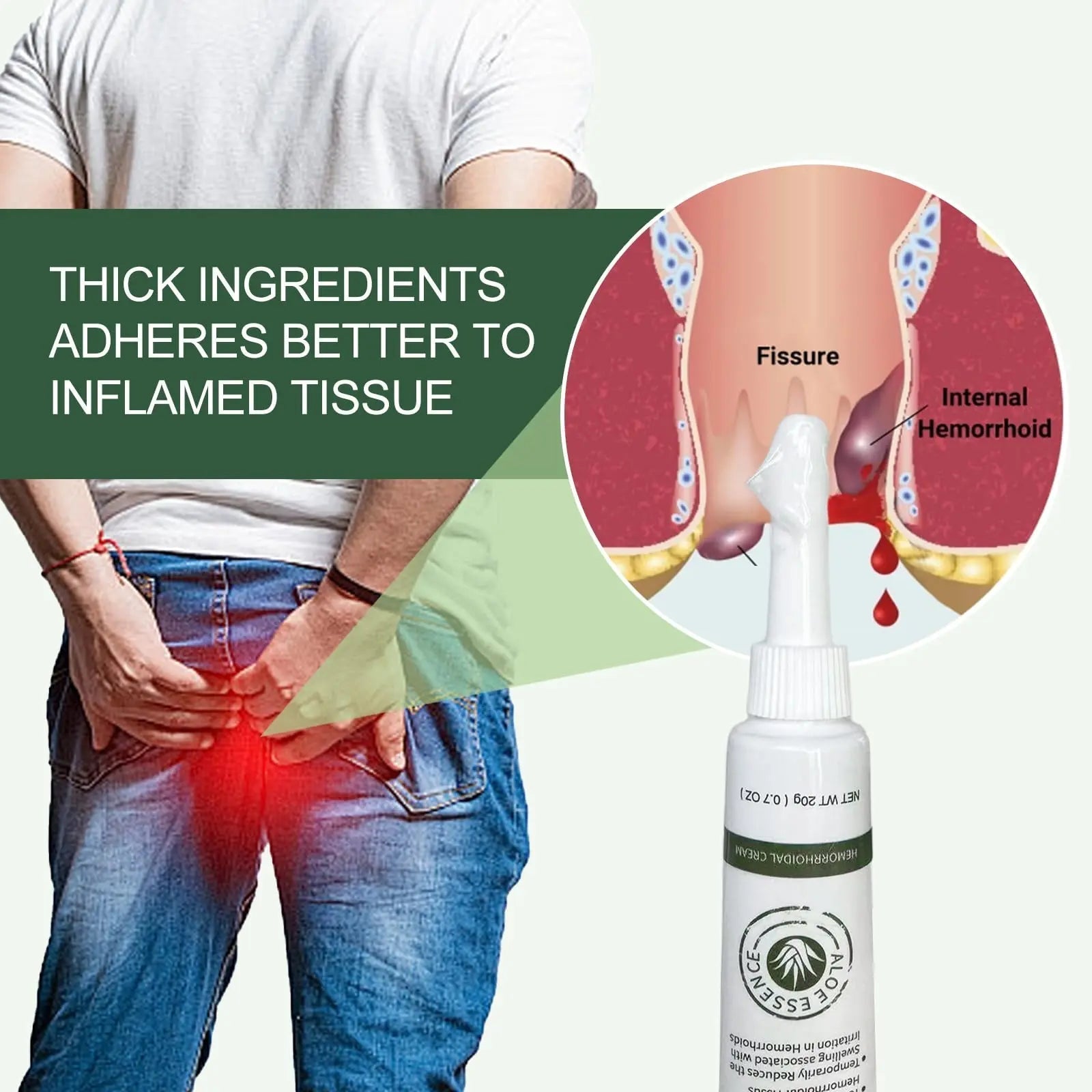 Hemorrhoid & Fissure Ointment, Hemorrhoid Treatment and Hemorrhoid Cream with Lidocaine 4% and Phenylephrine HCI for Fast Relief of Pain, Swelling, Itching, Burning, Hemorrhoidal treatment, 2 Pack-J2 Emisun uk supplements