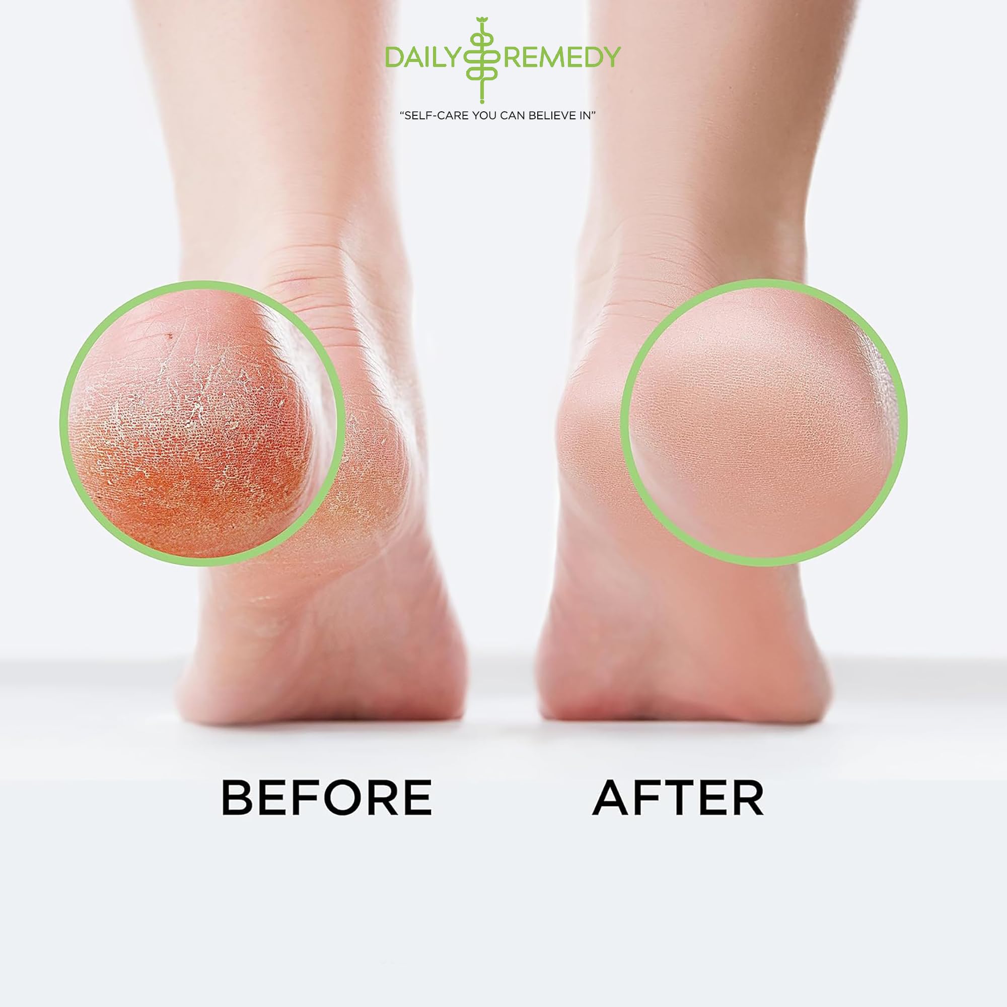 Tea Tree Oil Foot Soak with Epsom Salt - Made in USA - for Toenail Athletes Foot DAILY REMEDY uk supplements