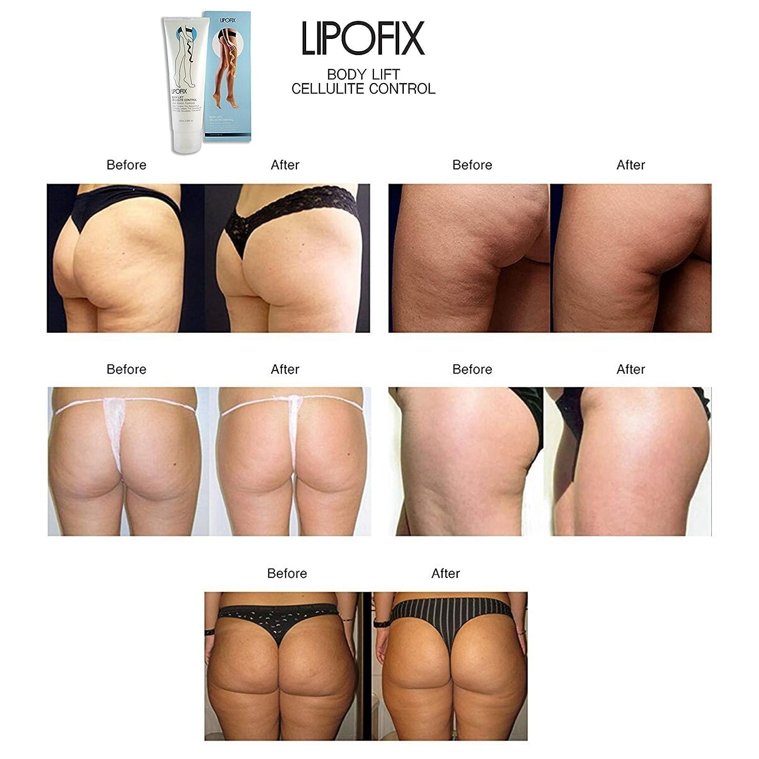 LIPOFIX Anti Cellulite Cream Luxurious Formula Body Contour Cream Effectively Tone LIPOFIX uk supplements