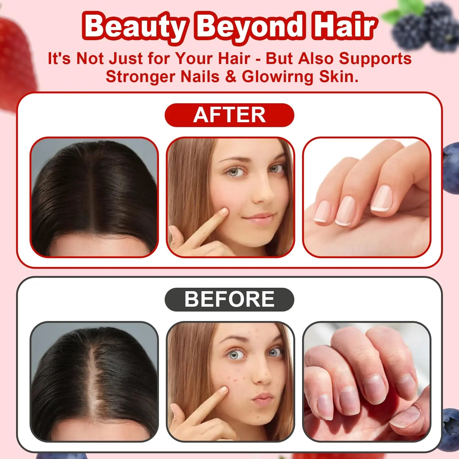 LUIMOLL Lumin Hair Growth Gummies – Daily Hair Nourishment with Biotin, Collagen & Botanical Extracts – Supports Thicker, Stronger & Healthier-Looking Hair LUIMOLL uk supplements