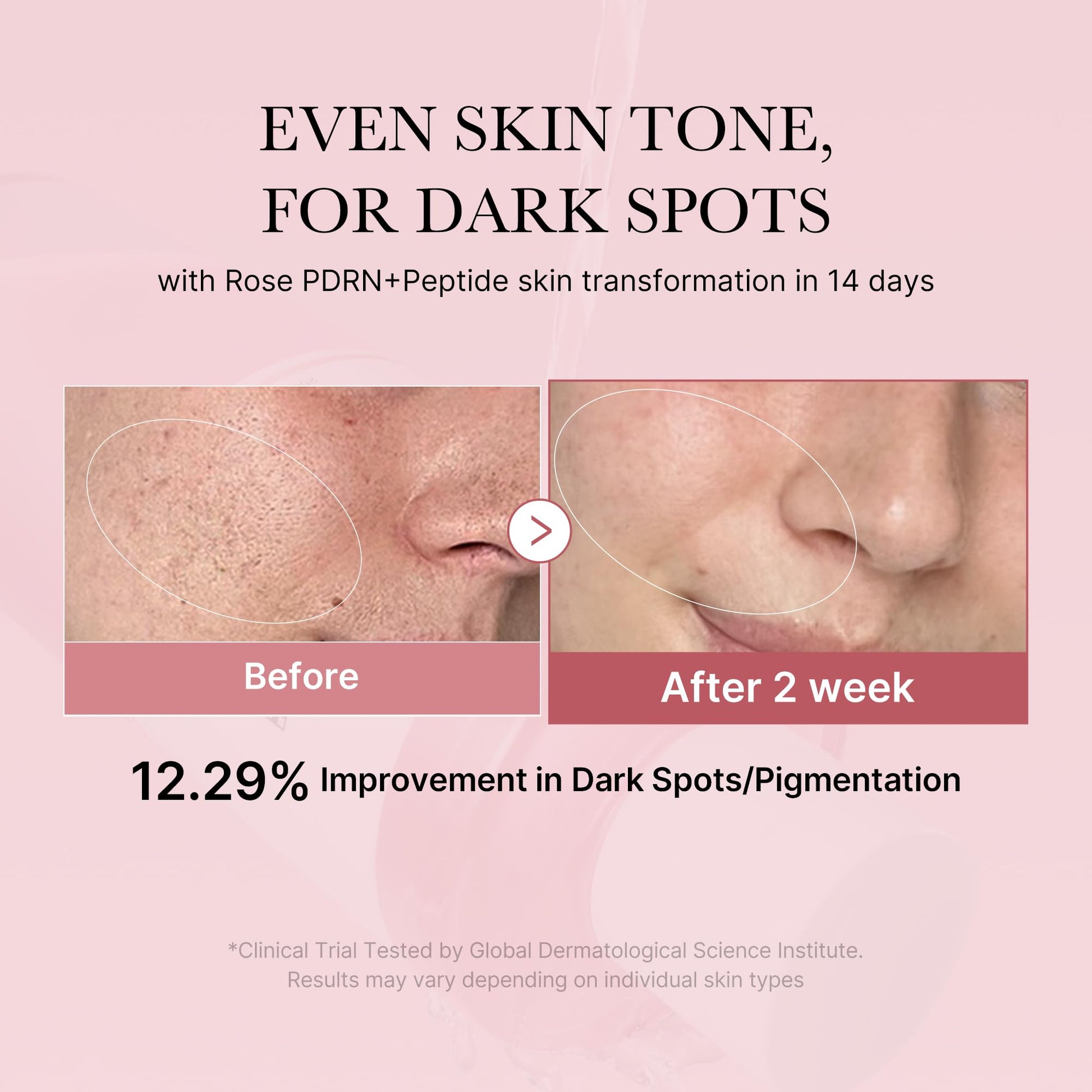 medicube PDRN Toner Rose PDRN Peptide Toner | Lightweight & Watery Type for Skin Boosting, Soothing and Calming, Uneven Skin Tone | with Rose, Peptide, Niacinamide | Korean Skincare, 8.45 fl.oz medicube uk supplements
