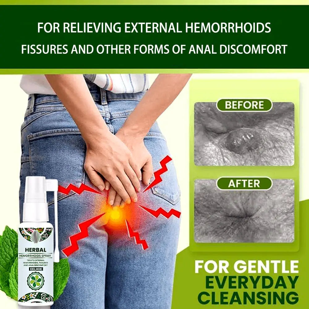 Juztec Hemorrhoid Treatment - Fast Relief with Hemocare Herbal Hemorrhoids Spray & Analese Numb Cream (1 PCS) Juztec uk supplements