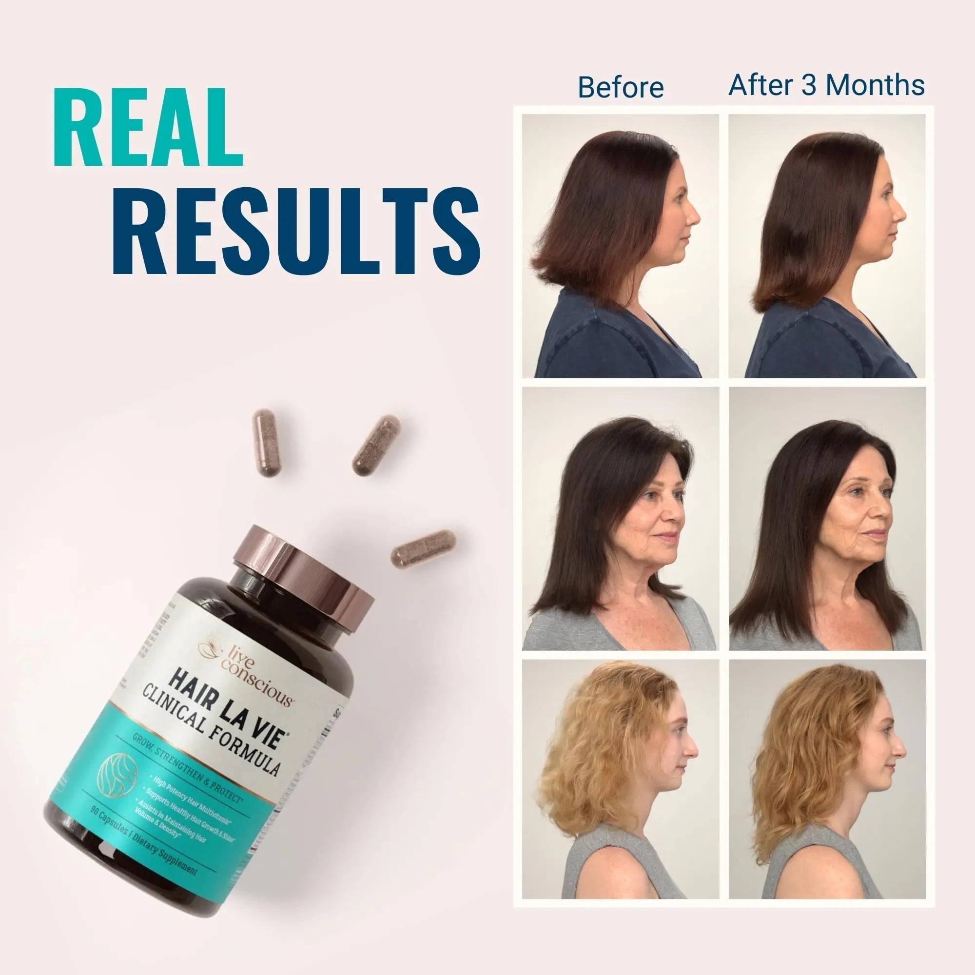 Hair La Vie Live Conscious Clinical Formula Hair Growth Vitamins for Women and Men w/Biotin, Collagen & Saw Palmetto (Pack of 1) Hair La Vie uk supplements