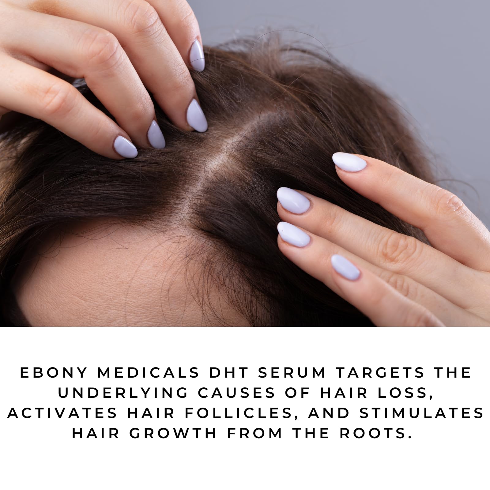 Ebony Medicals DHT Blocker Hair Growth Serum - Hair Loss Supplement, Supports Natural Regrowth Natural Curves uk supplements