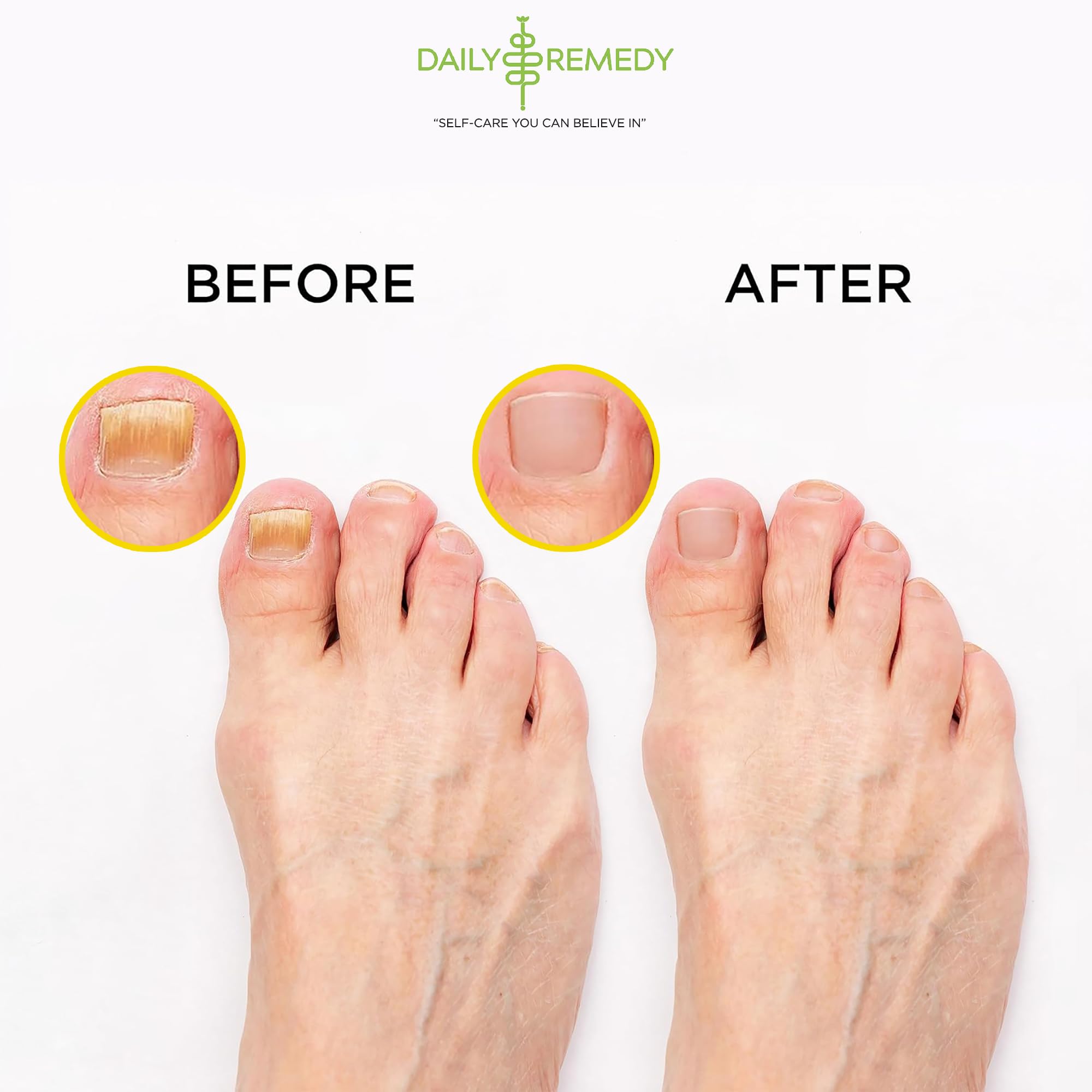 Citrus Detox Foot Soak with Epsom Salt - for Foot Callus, Immune Boost, Damaged Toenail DAILY REMEDY uk supplements
