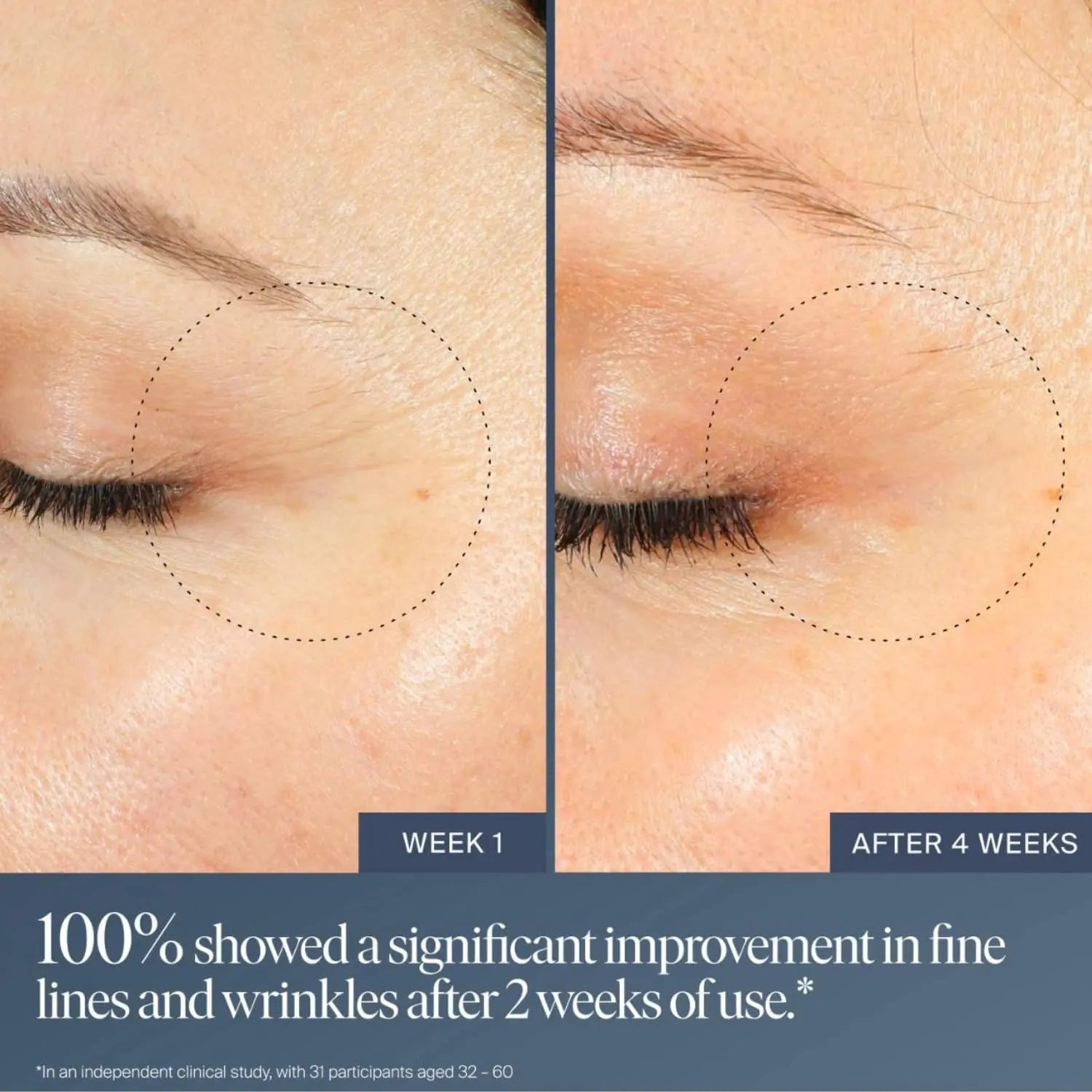 Summer Fridays Jet Lag Overnight Eye Serum - Nourishing Undereye Treatment for Dark Circles - Helps to Hydrate, Smooth, Firm & Depuff - Enriched with Glycerin to Lock in Moisture (0.5 Fl Oz) Summer Fridays uk supplements