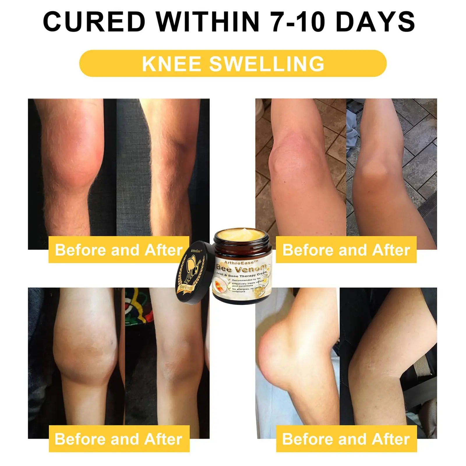 ArthroEase Bee Venom Joint and Bone Cream,ArthroEase Bee Venom Cream,Bee Venom Joint Gel,Effectively Relieve Joint discomfort (2) ADFIRE uk supplements