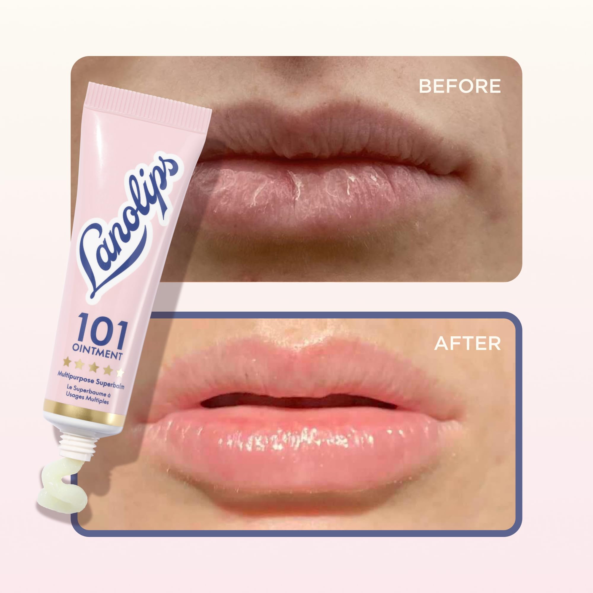 Lanolin 101 Multipurpose Ointment - Lanolin Lip Balm & Healing Ointment for Skin Barrier Repair - Moisturizer for Dry Lips, Cuticles & Elbows - No Petroleum Formula - Original Superbalm (0.52 oz) Lanolips uk supplements