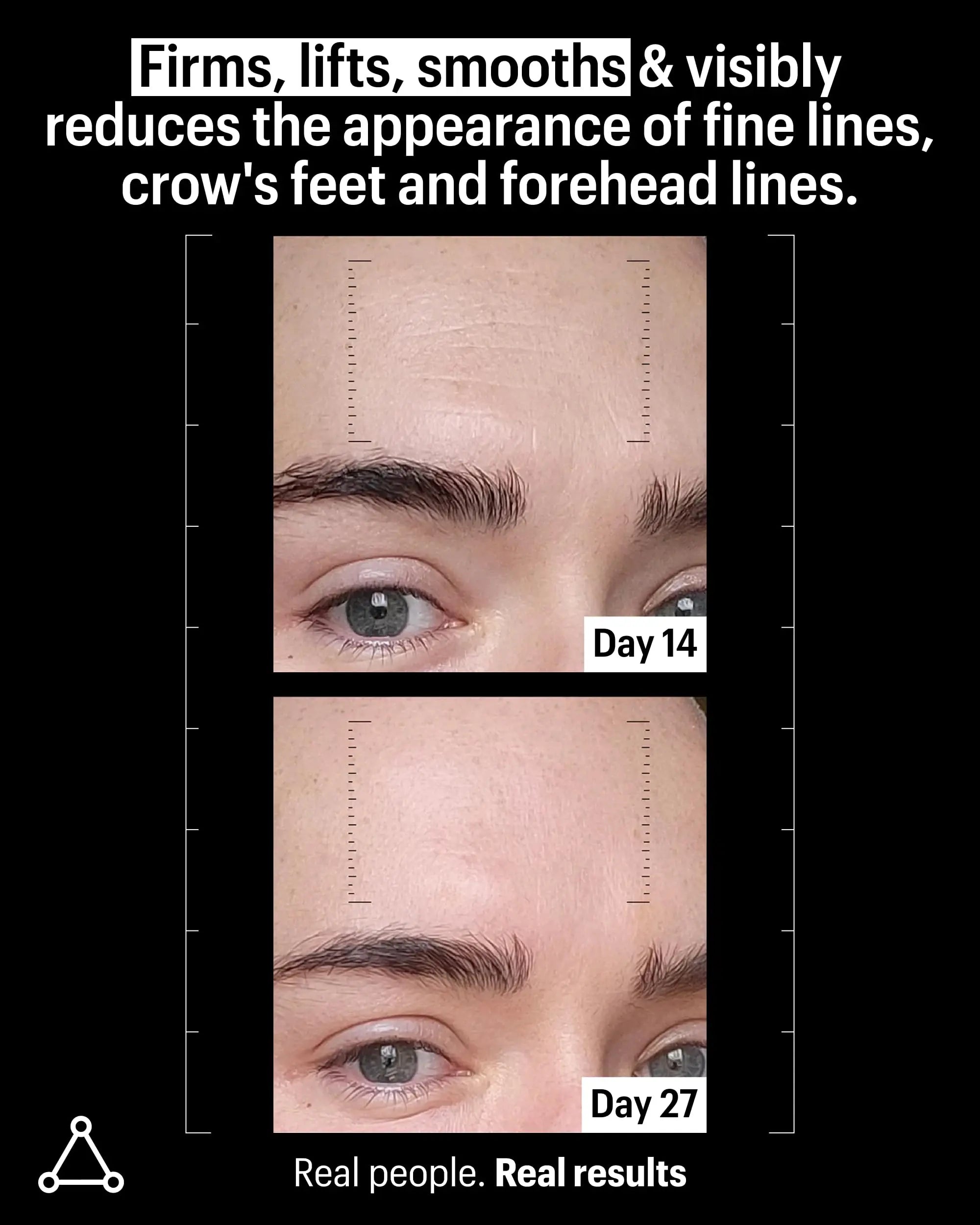 Allies of Skin Multi Peptides & Growth Factor Collagen Boosting Face Serum | Skin Tightening Anti-Aging Complex with 9% Peptides| Firms Sagging Skin & Visibly Reduces Wrinkles (1 oz) Allies of Skin uk supplements