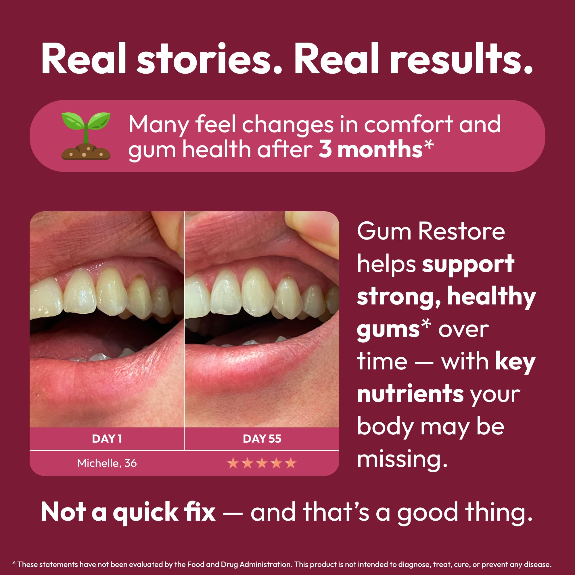 Strong Jaw Gum Restore - Gum Repair for Receding Gums | Teeth Magnesium Supplements, Oral Care, Remineralizing Dental Health Vitamins for Adults | 1 Month Supply, 180 Capsules, Made in USA Strong Jaw uk supplements