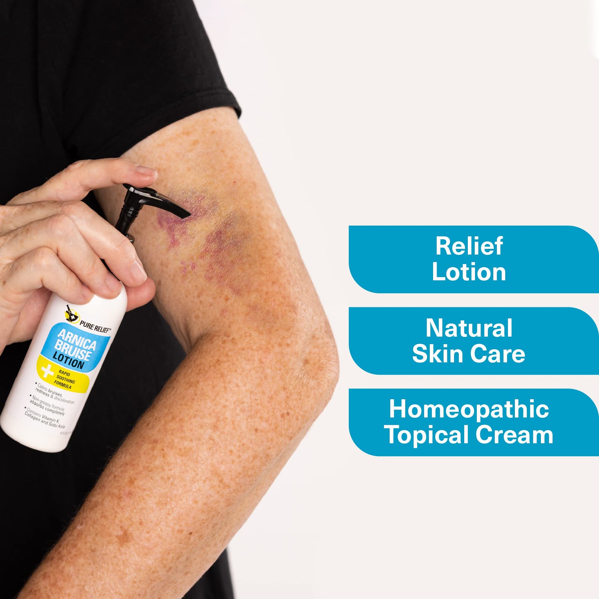 Pure Relief Arnica Bruise Relief Lotion for Bruising, Swelling, & Discoloration On Skin, Natural Skin Care Arnica Bruise Homeopathic Topical Bruise Cream W/Aloe Vera & Collagen, 4 Fl Oz (Pack of 3) Pure Relief uk supplements
