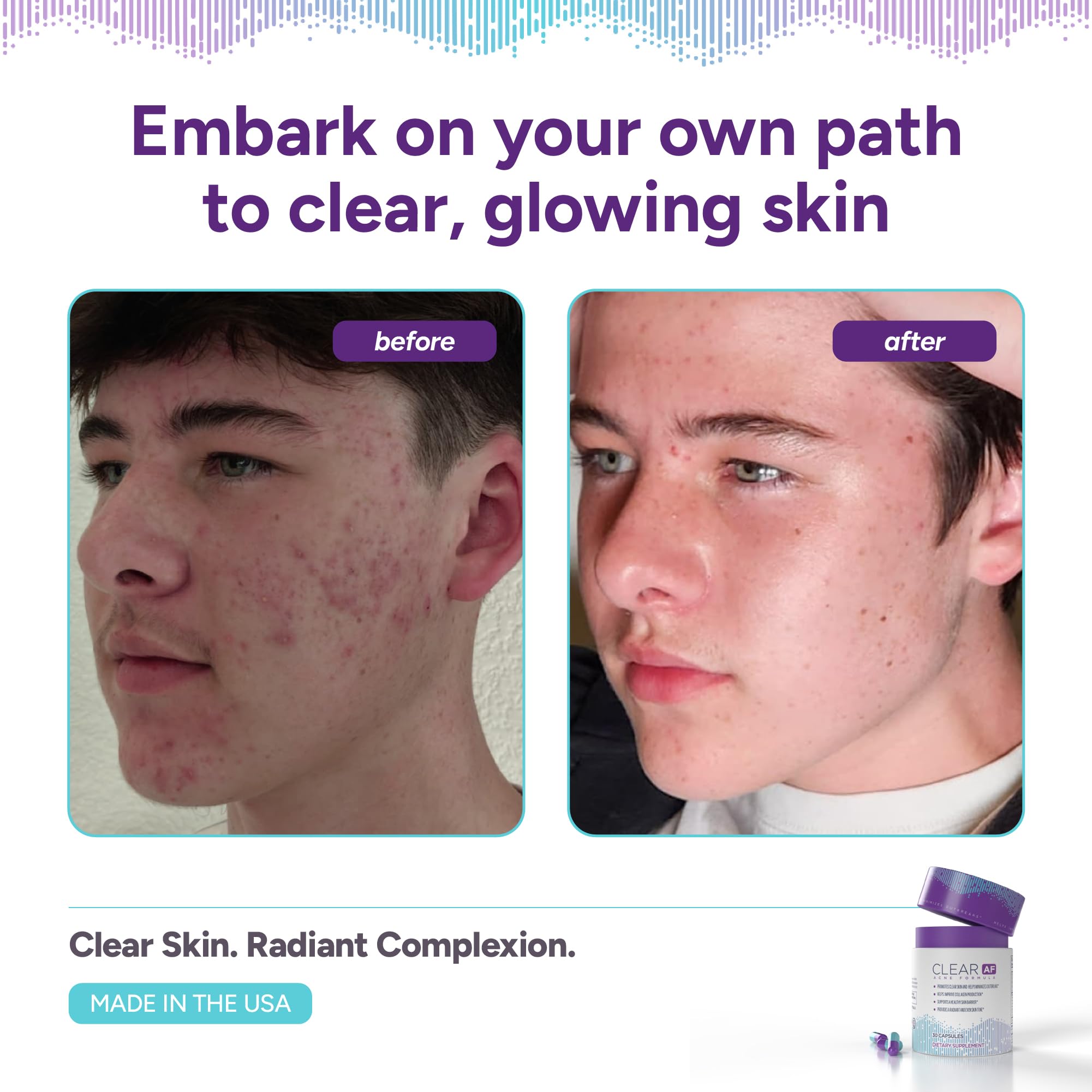 Clear AF Clear Skin Supplement | Skin Barrier Hydration & Clear Complexion Support with Vegan Ceramides, Zinc, Vitamin D3, B6, Riboflavin & Thiamine | Vegan Capsules | 30-Day Supply Clear AF uk supplements