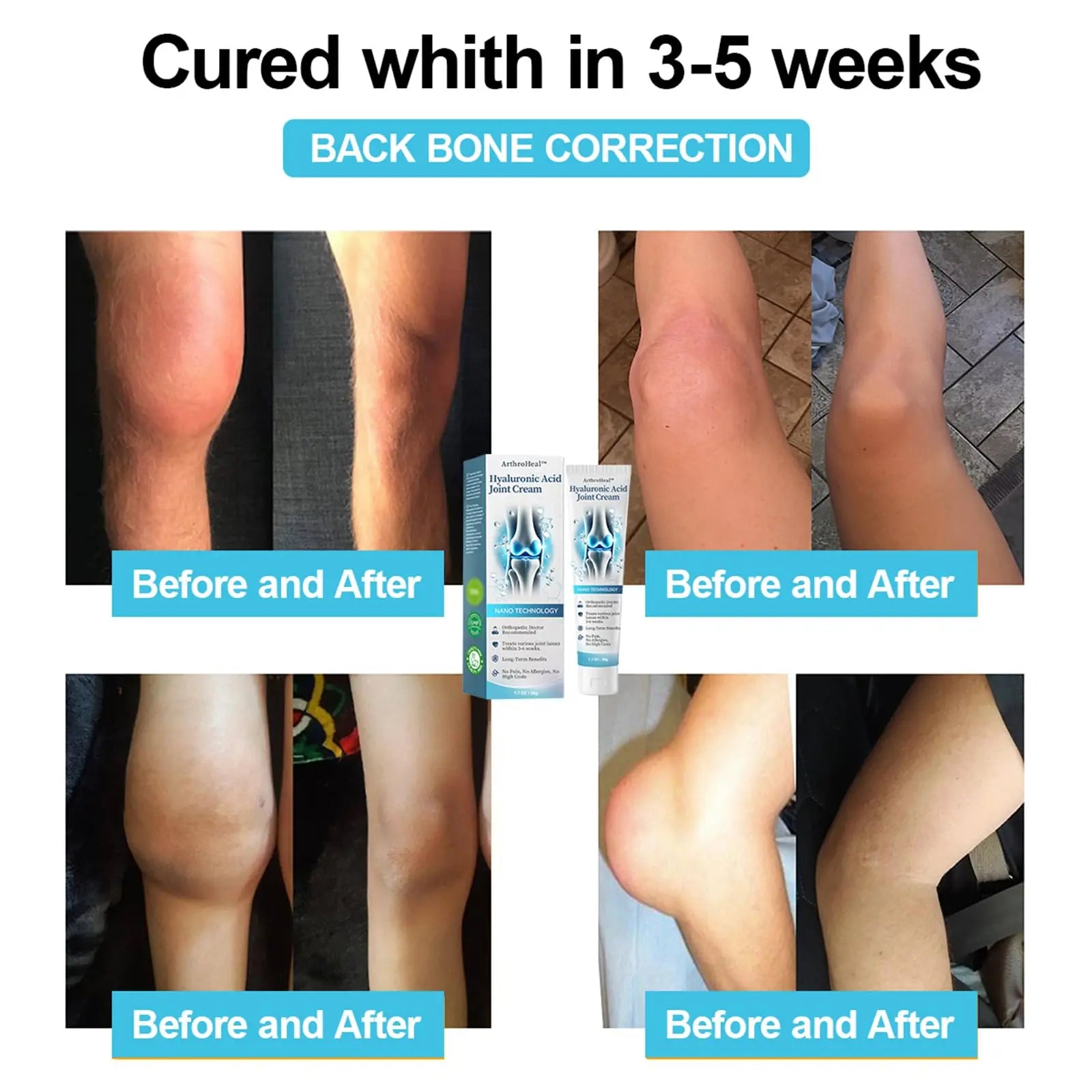 Luhaka ArthroHeal Hyaluronic Acid Joint R-epair Cream,ArthroHeal Joint Cream,Quickly relieve joint discomfort, Quickly relieve joint discomfort, suitable for joint activities throughout the body (1) Luhaka uk supplements