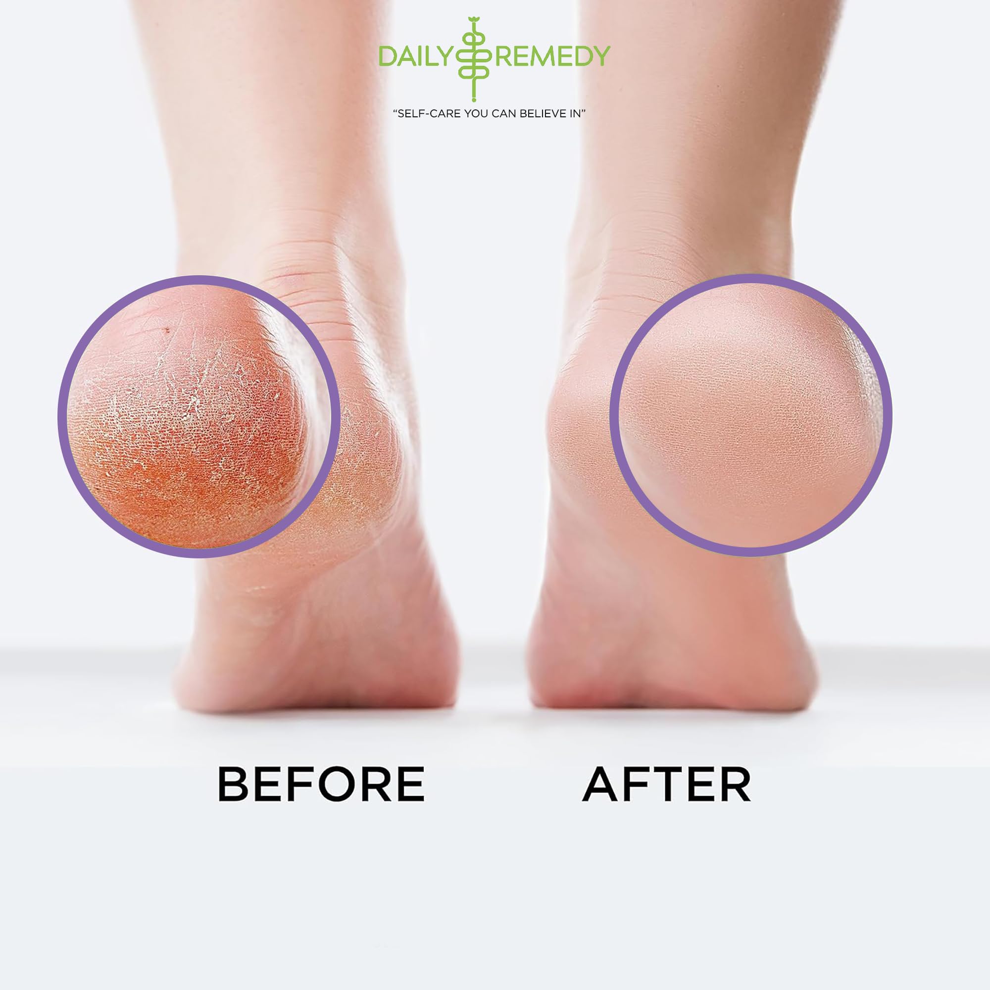 Calming Lavender Foot Soak with Epsom Salt, Made in USA, Foot Soak Soothes Sore Tired DAILY REMEDY uk supplements