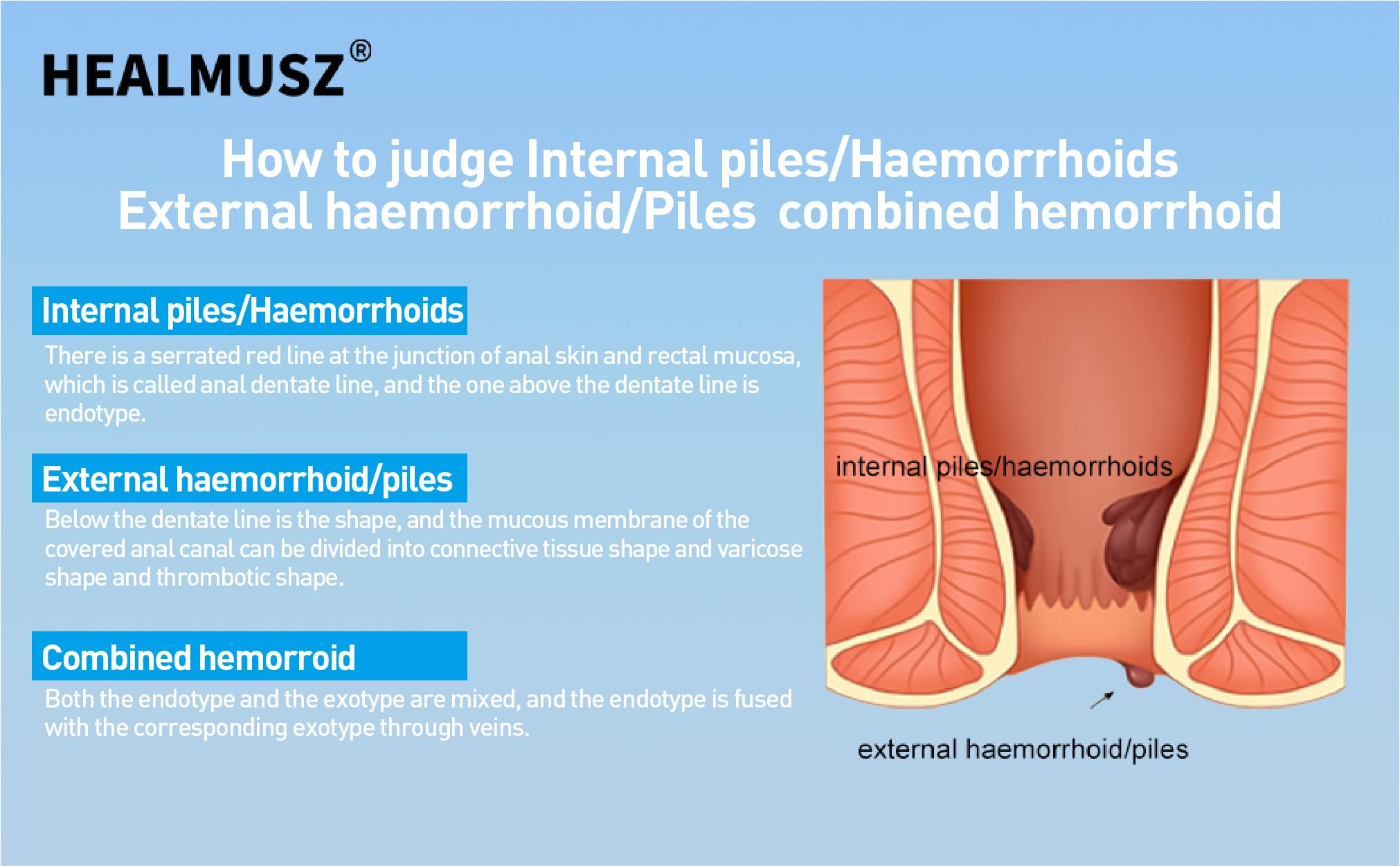 HEALMUSZ Hemorrhoid Fissure Ointment– Hemorrhoid Treatment and Hemorrhoid Cream with Lidocaine and Phenylephrine HCI for Fast Acting Relief of Pain, Swelling, Discomfort, and Itching(1.5 oz) HEALMUSZ uk supplements
