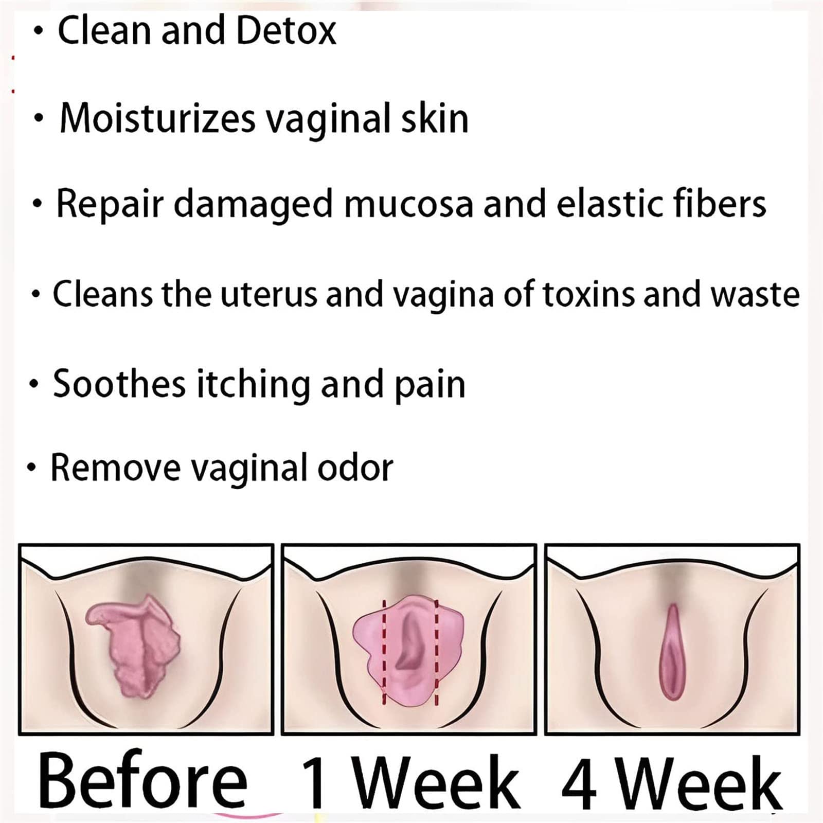 AnnieCare Instant Anti-Itch Detox Slimming Products, Annie Care Natural Detox Viginal Gel DASHENRAN uk supplements