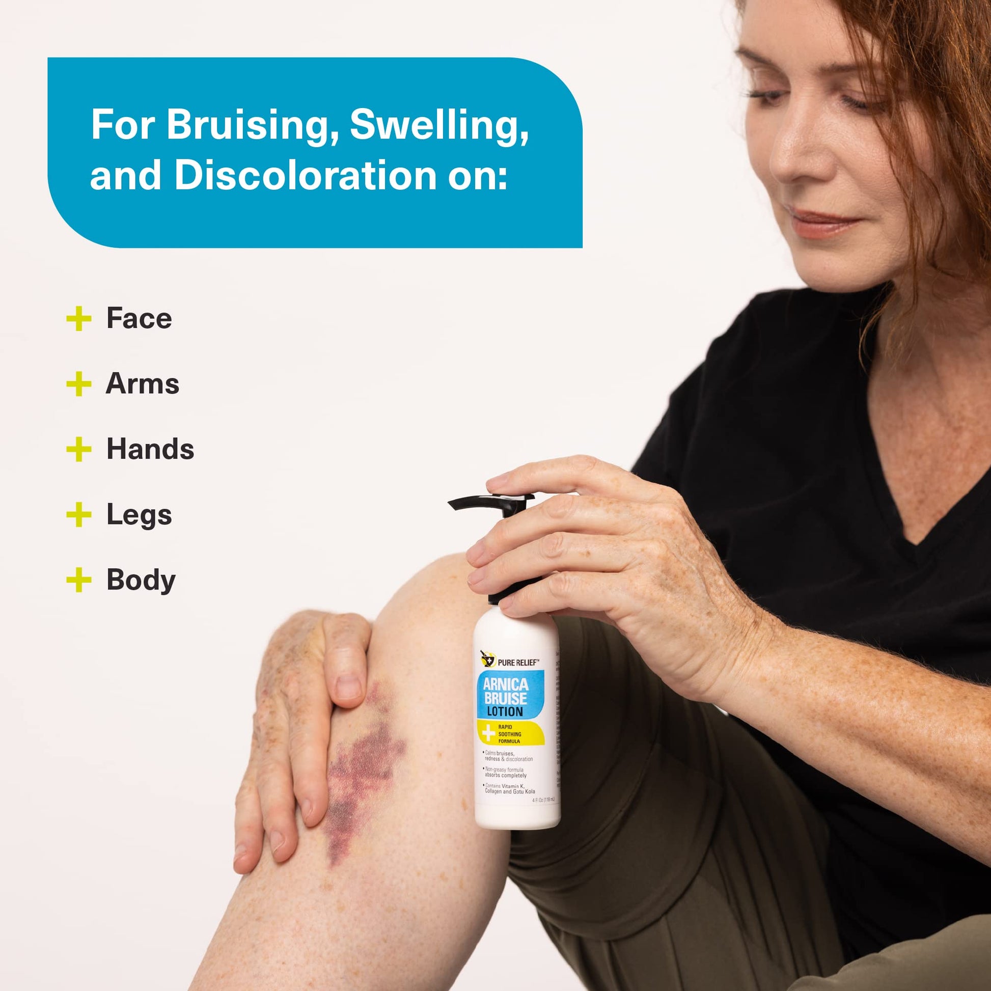 Pure Relief Arnica Bruise Relief Lotion for Bruising, Swelling, & Discoloration On Skin, Natural Skin Care Arnica Bruise Homeopathic Topical Bruise Cream W/Aloe Vera & Collagen, 4 Fl Oz (Pack of 3) Pure Relief uk supplements