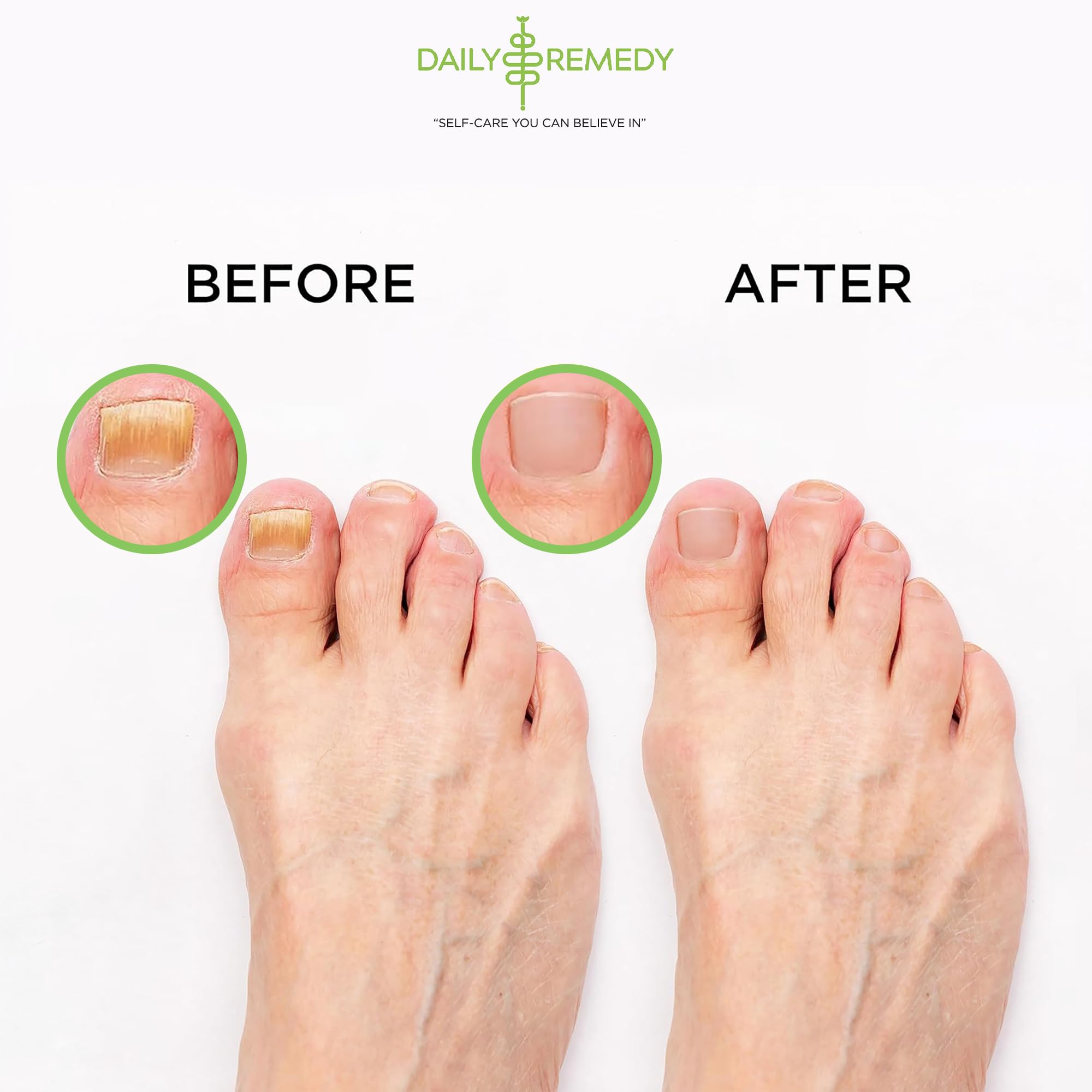 Tea Tree Oil Foot Soak with Epsom Salt - Made in USA - for Toenail Athletes Foot DAILY REMEDY uk supplements