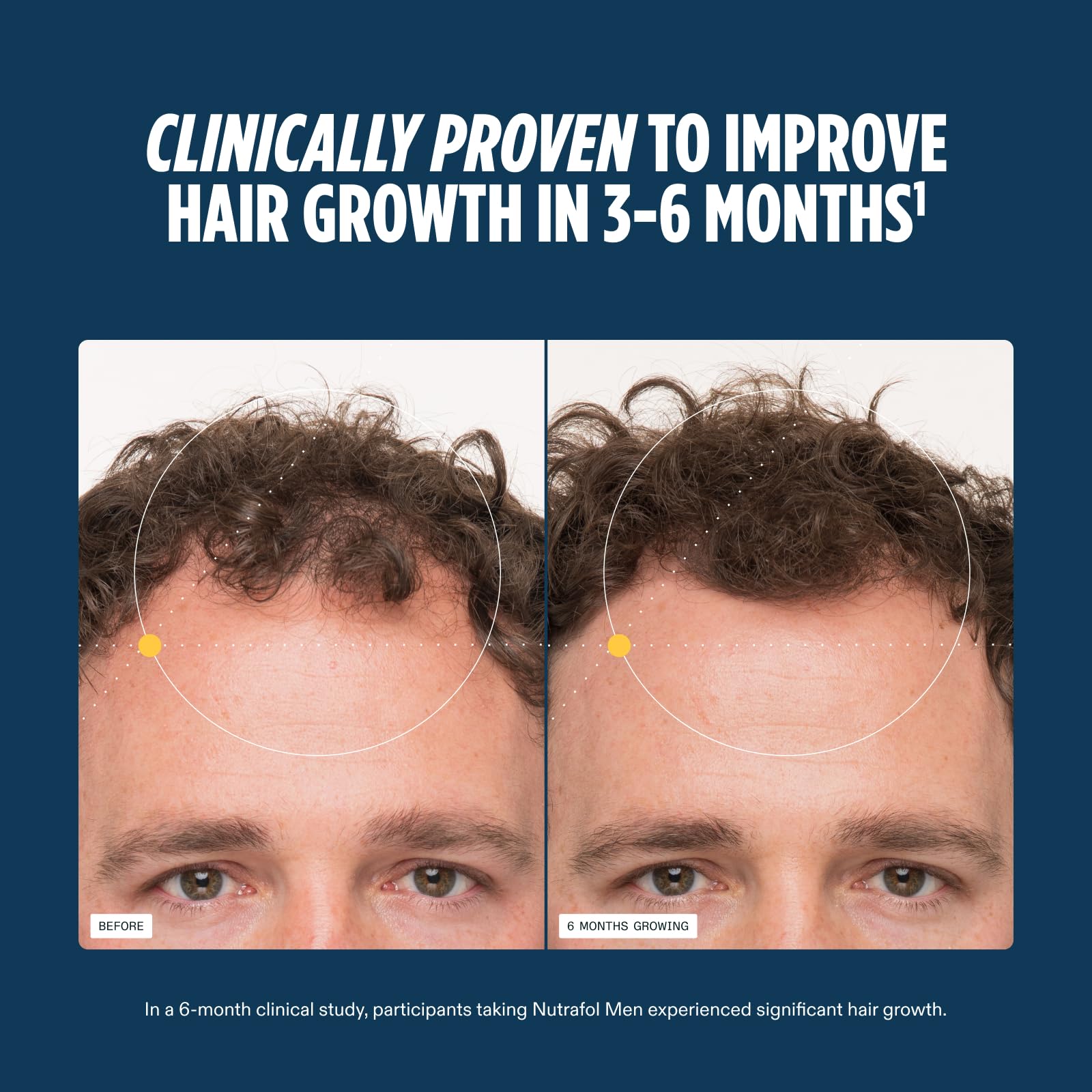 Nutrafol Men's Hair Growth Supplements, Clinically Tested for Visibly Thicker Hair and Scalp Coverage, Dermatologist Recommended - 1 Month Supply Nutrafol uk supplements