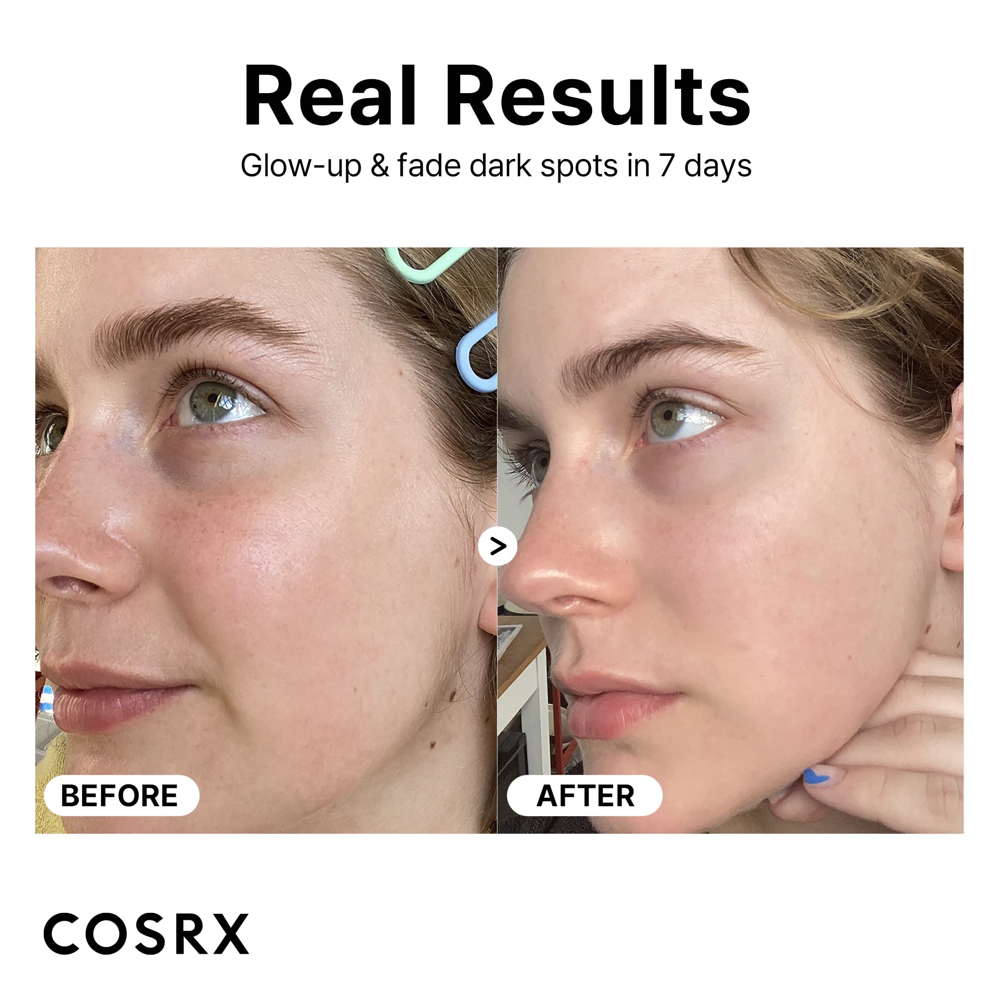 COSRX Pure Vitamin C Serum with Vitamin E & Hyaluronic Acid, Brightening COSRX uk supplements