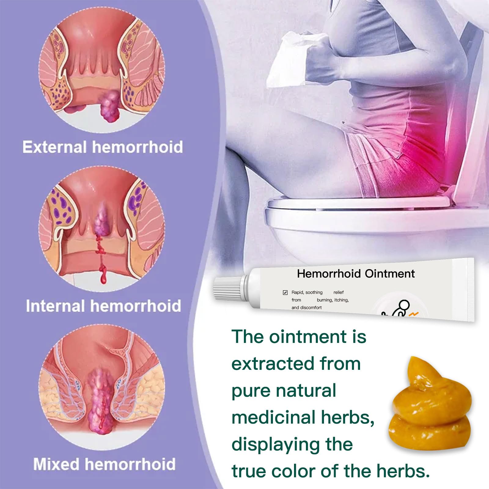 BXQJRJ Hemorrhoid Ointment,Herbal hemorrhoid Gel,Effectively relieves Anal discomfort,Suitable for Men and Women,Fast-Acting hemorrhoid Ointment (20g) BXQJRJ uk supplements