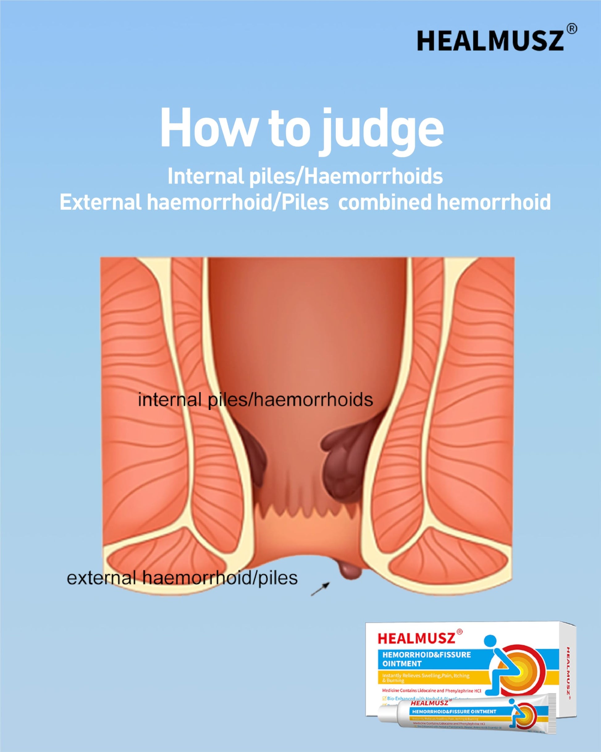 HEALMUSZ Hemorrhoid Fissure Ointment– Hemorrhoid Treatment and Hemorrhoid Cream with Lidocaine and Phenylephrine HCI for Fast Acting Relief of Pain, Swelling, Discomfort, and Itching(1.5 oz) HEALMUSZ uk supplements