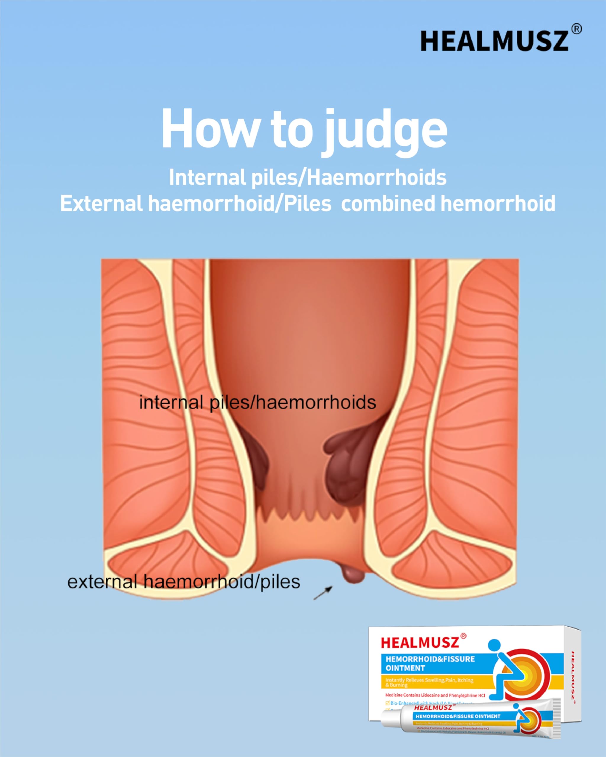 HEALMUSZ Hemorrhoid Fissure Ointment– Hemorrhoid Treatment and Hemorrhoid Cream with Lidocaine and Phenylephrine HCI for Fast Acting Relief of Pain, Swelling, Discomfort, and Itching(1.5 oz) HEALMUSZ uk supplements