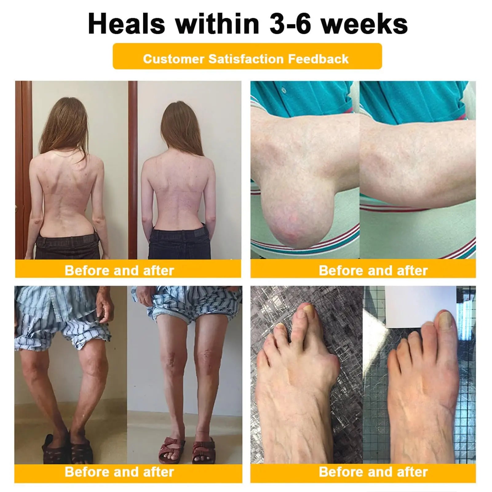 Luhaka Botulinum Toxin & Bee Venom Pain-Relief Bone Healing Cream,Bee Venom Cream,Effectively improve joint mobility (1PC) Luhaka uk supplements