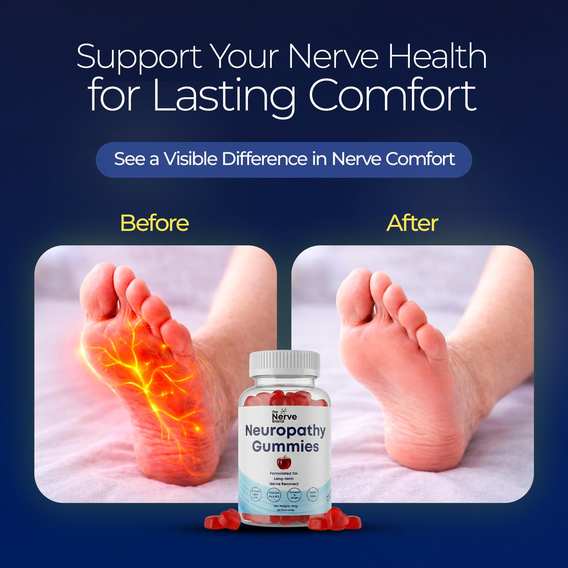 The Nerve Brand Neuropathy Support Gummies, 600 mg R Alpha Lipoic Acid Gummies with B1 B6 B12 and Lion’s Mane, Sugar Free Daily Nerve Health Supplement, 30 Day Supply The Nerve Brand uk supplements