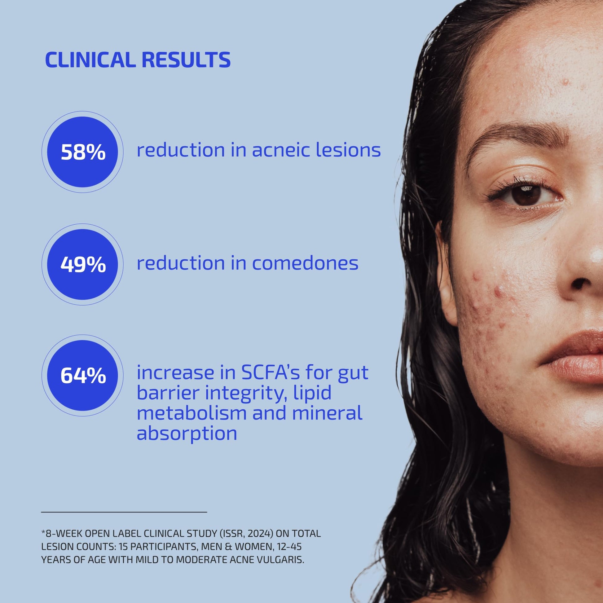 Codex Labs Shaant Clear Skin Supplement – 60 Vegan Capsules | Acne Probiotics with 9-Strain Blend, Green Tea EGCG & Guggul – Daily Support for Acne-Prone Skin & Clear Complexion Codex Labs uk supplements