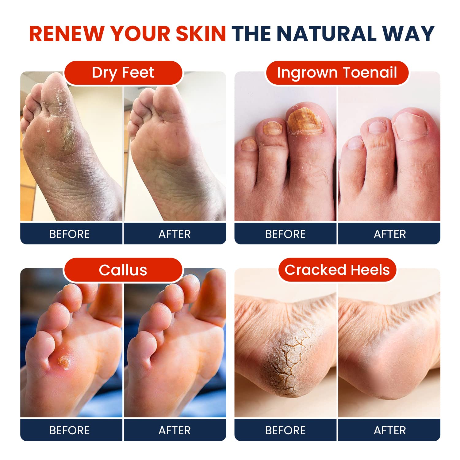 Muscle Relief Foot Soak with Epsom Salts - All Natural Salts for Post Workout Recovery FOOT CURE uk supplements