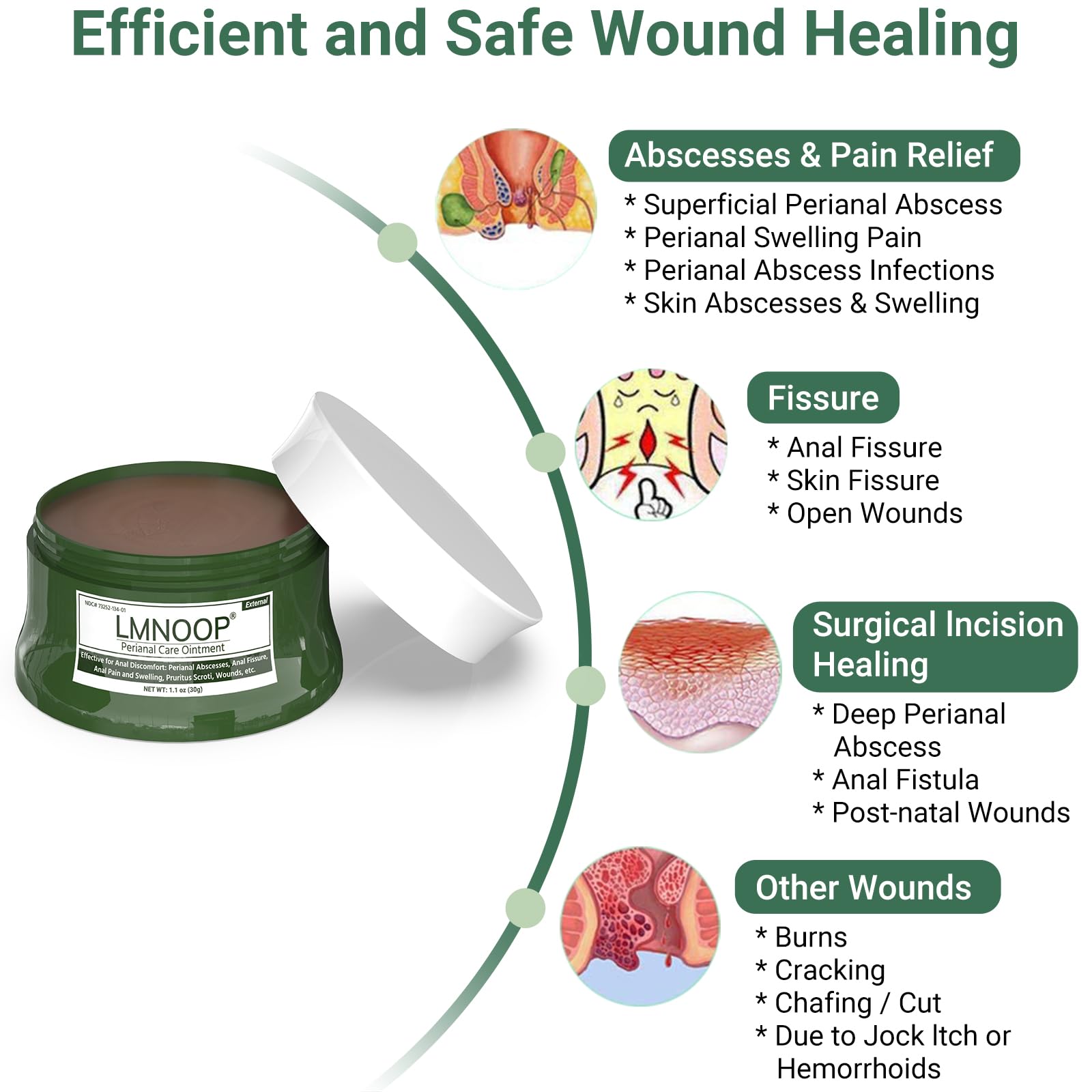 LMNOOP Perianal Repair Ointment: Treatments for Anal Fistula, Anal Fissure, Perianal Abscess, Rapid Relief from Pain, Burning, Itching, Swelling, Bleeding, and Discomfort by Jock Itch or Hemorrhoids LMNOOP uk supplements