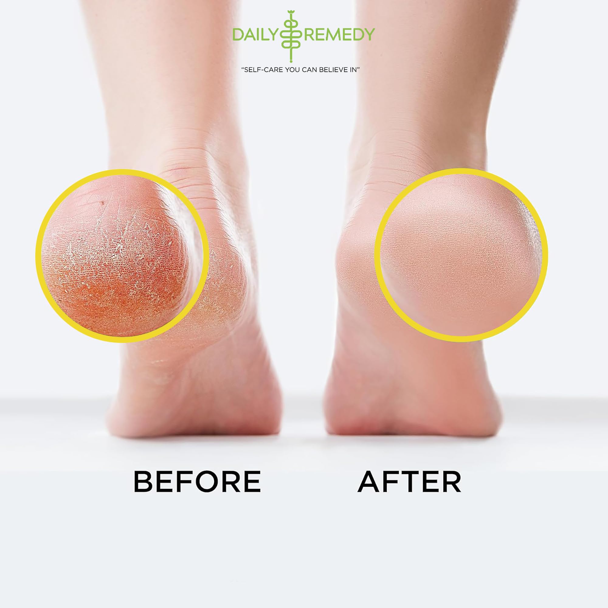 Citrus Detox Foot Soak with Epsom Salt - for Foot Callus, Immune Boost, Damaged Toenail DAILY REMEDY uk supplements