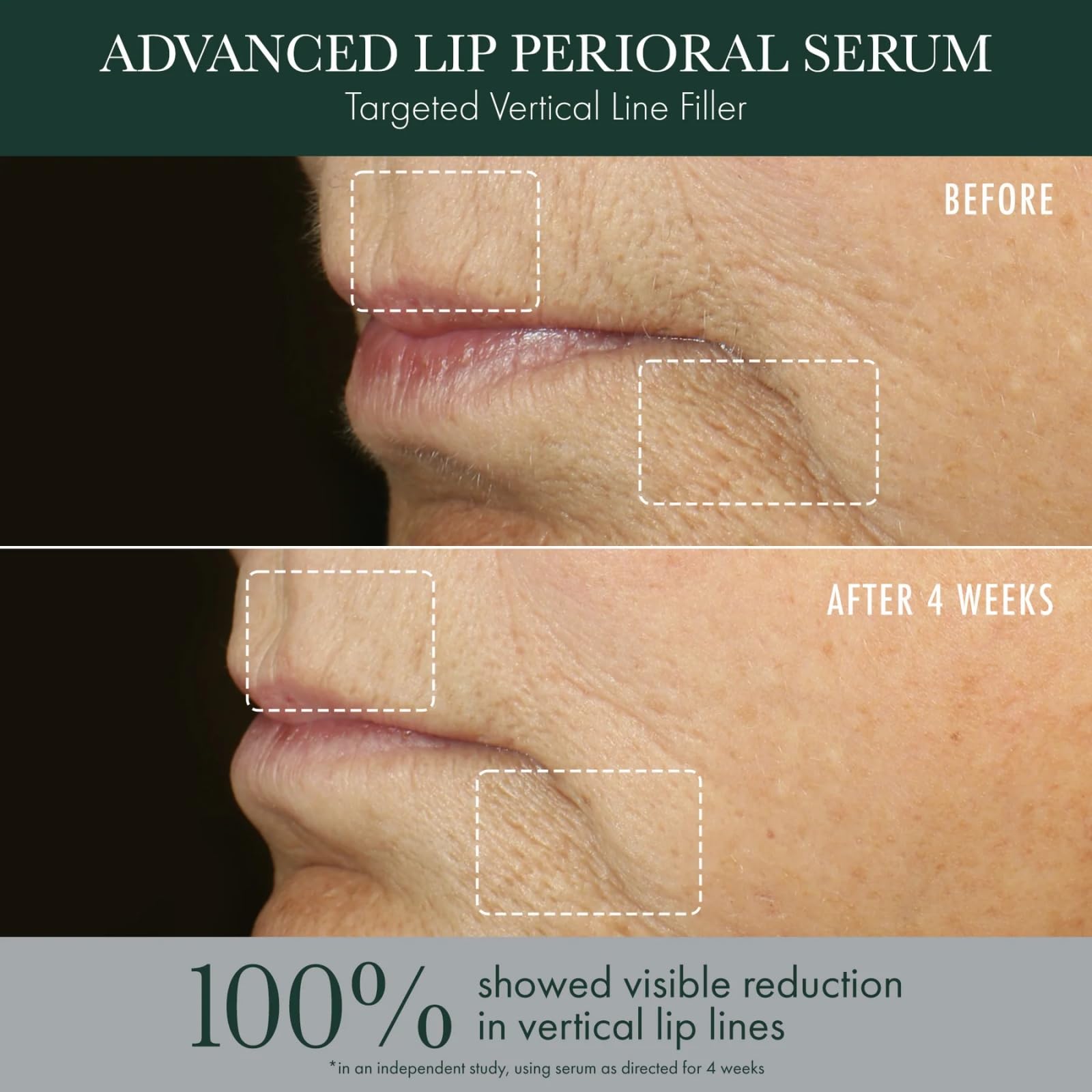 RéVive Advanced Perioral Lip Serum - Anti Aging Perioral Lip Treatment to Reduce Lip Area Lines & Wrinkles -Helps Restore Lip Contour & Visible Fullness(0.5 fl oz) RéVive uk supplements
