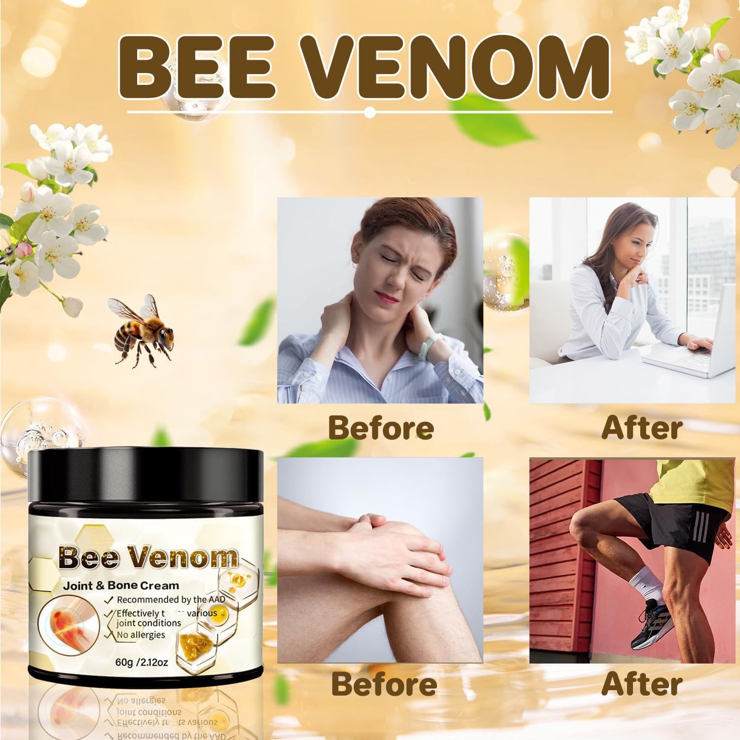 ArthroEase Bee Venom Arthritis Cream, Joint & Muscle Soothing Bee Venom Cream, Professional Bee Venom Joint Cream, Bee Venom Joint Gel - Specially for for Back, Neck, Hands, Knee (2 Bottle) Lmoy uk supplements