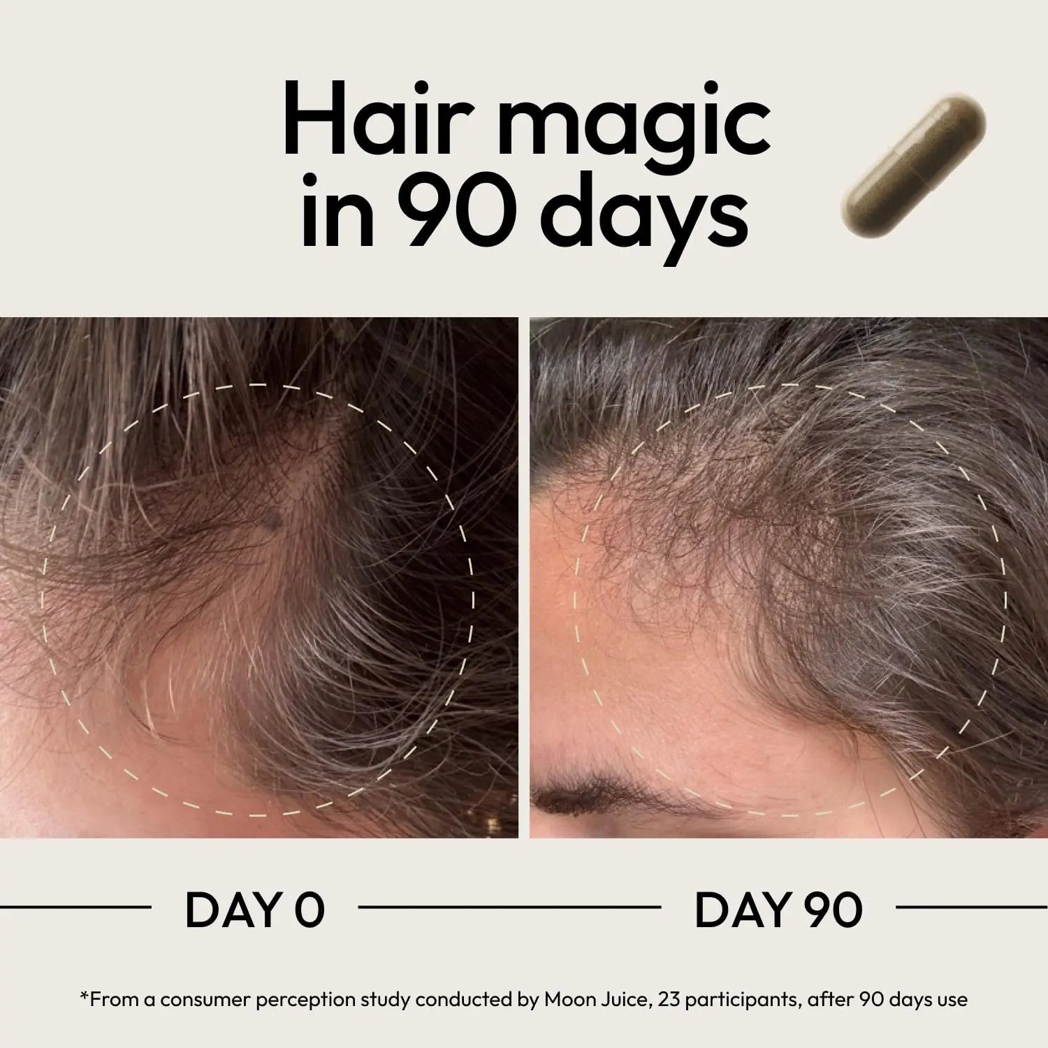 Moon Juice SuperHair Hair Growth Vitamins for Women & Men with Biotin & Saw Palmetto - Clinical Strength Multivitamin Hair Supplement Moon Juice uk supplements