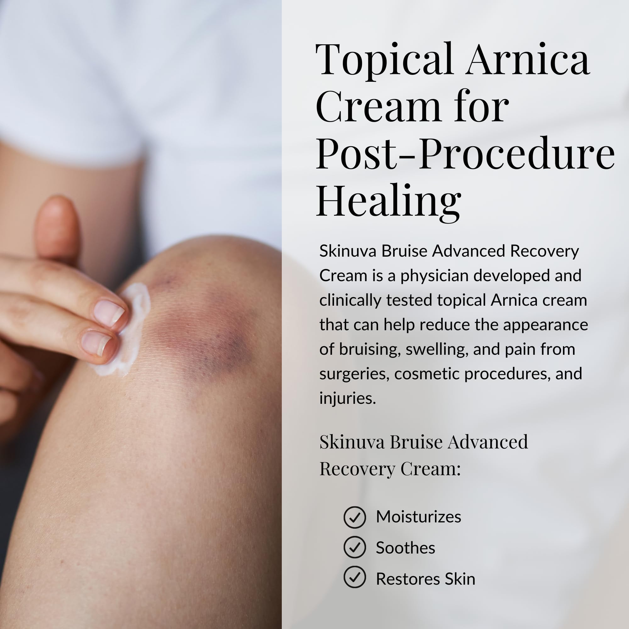 Skinuva® Bruise Advanced Recovery Cream - Topical Bruise Cream Formulated with Growth Factors, Arnica & Vitamin K (1 oz) Skinuva uk supplements