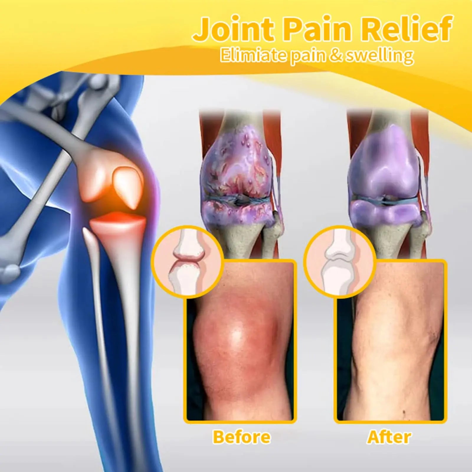 Luhaka Botulinum Toxin & Bee Venom Pain-Relief Bone Healing Cream,Bee Venom Cream,Effectively improve joint mobility (1PC) Luhaka uk supplements
