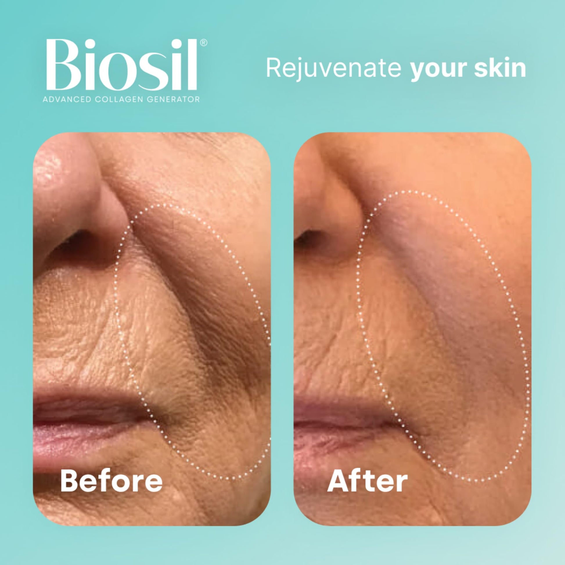 Biosil Collagen Generator - 30 mL Drops - with Patented ch-OSA Complex BioSil uk supplements
